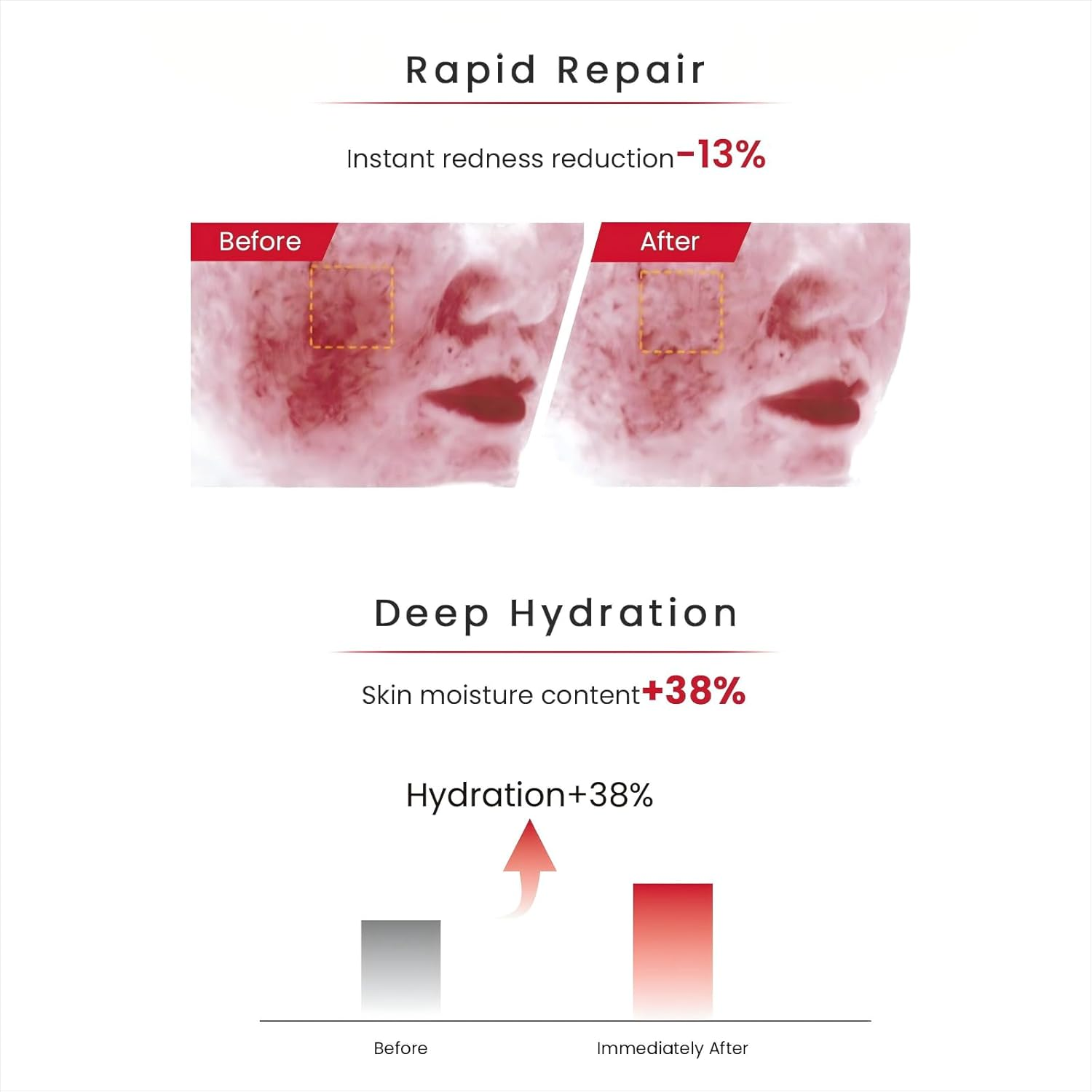 WINONA Facial Toner,Sensitiveness Relieving Moisturizing Tolerance-Extreme Lotion,Soothing and Moisturizing for Sensitive Skin,Hydrating Toner with Hyaluronic Acid for Daily Use (120Ml/4.06 Fl. Oz) image number 2