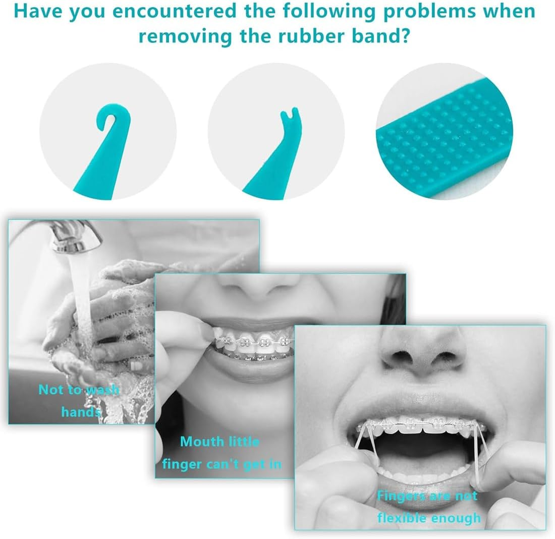 Pack of 10 Orthodontic Elastic Disposable Plastic Braces for Braces, Material Placement Removal Tools, Orthodontic Disposable Plastic Braces (Mixed Colour)