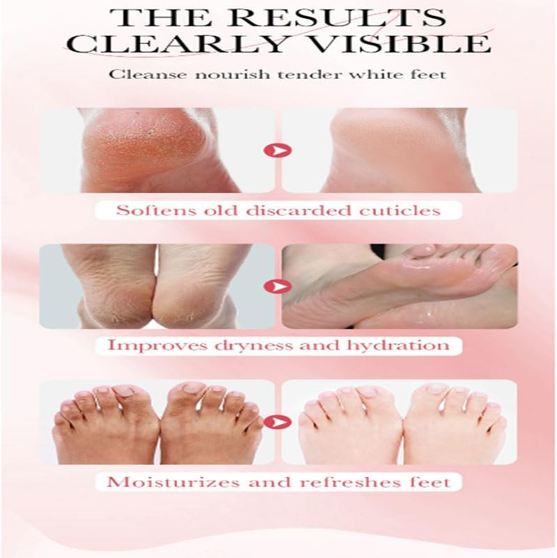 Whitening Foot Mask, Tender Skin, Moisturizing, Autumn and Winter Foot Care, Niacinamide Whitening Foot Mask 35G 1 Piece image number 3