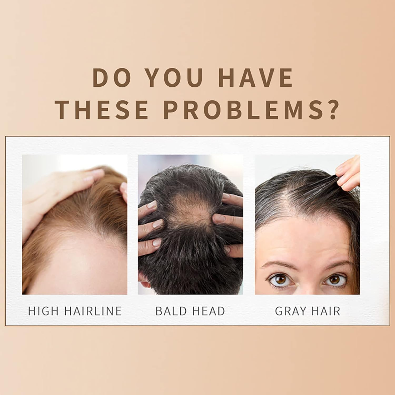 Roseflower 2Pcs Hair Fibers for Thinning Hair, Undetectable Natural Hair Thickening Fibers, Hair Building Fibers for Women and Men, Thicker Fuller Hair Conceals Hair Loss, Dark Brown 27.5G X 2 image number 1