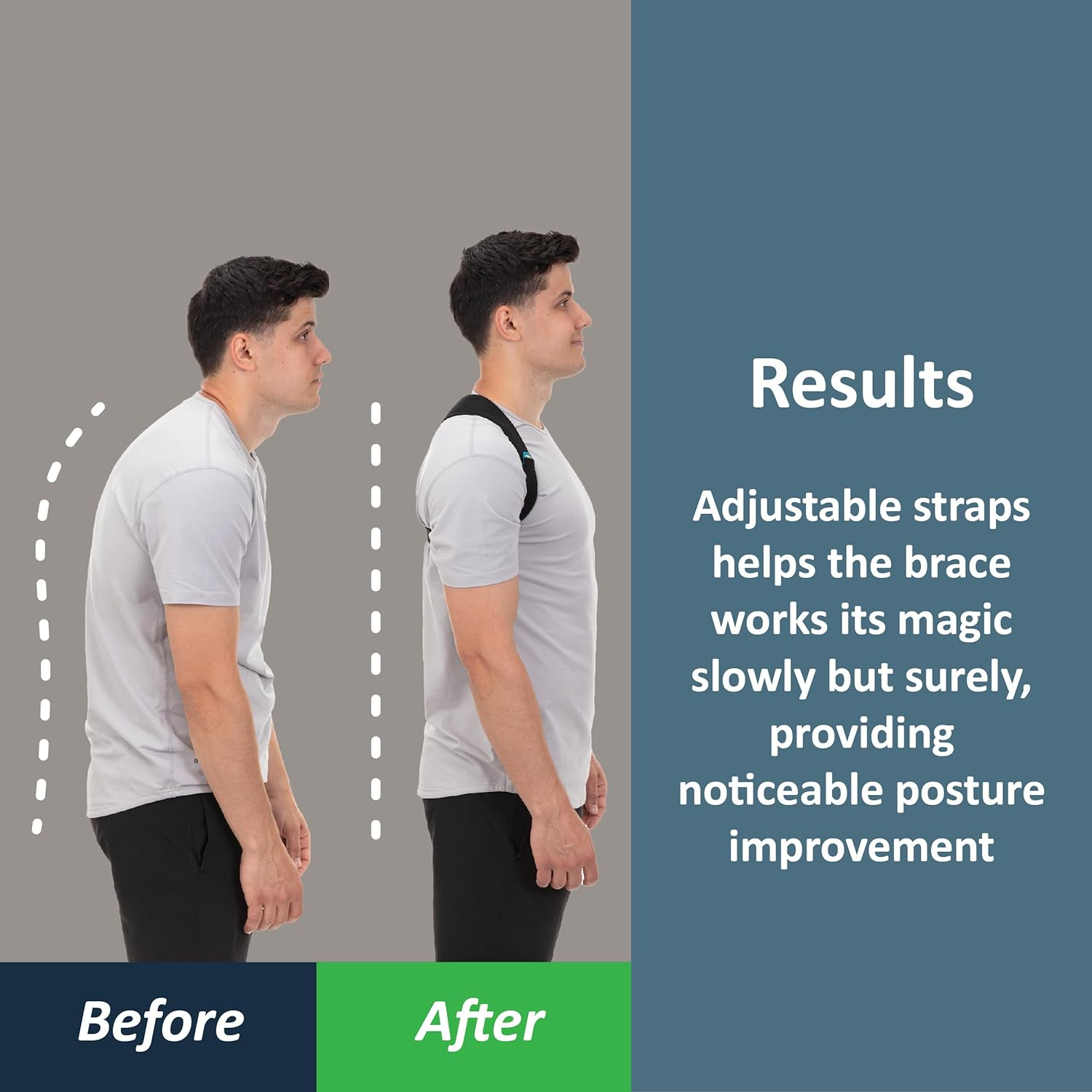 Posture Corrector for Women and Men, Caretras Adjustable Upper Back Brace for Clavicle Support image number 4