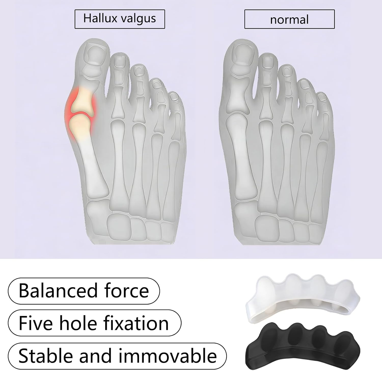 JANGJANG 4 Pairs Soft Gel Toe Separators, Bunion Corrector and Toe Straightener, Toe Spacers and Big Toe Stretcher for Pain Relief, Black and White Color Options image number 4