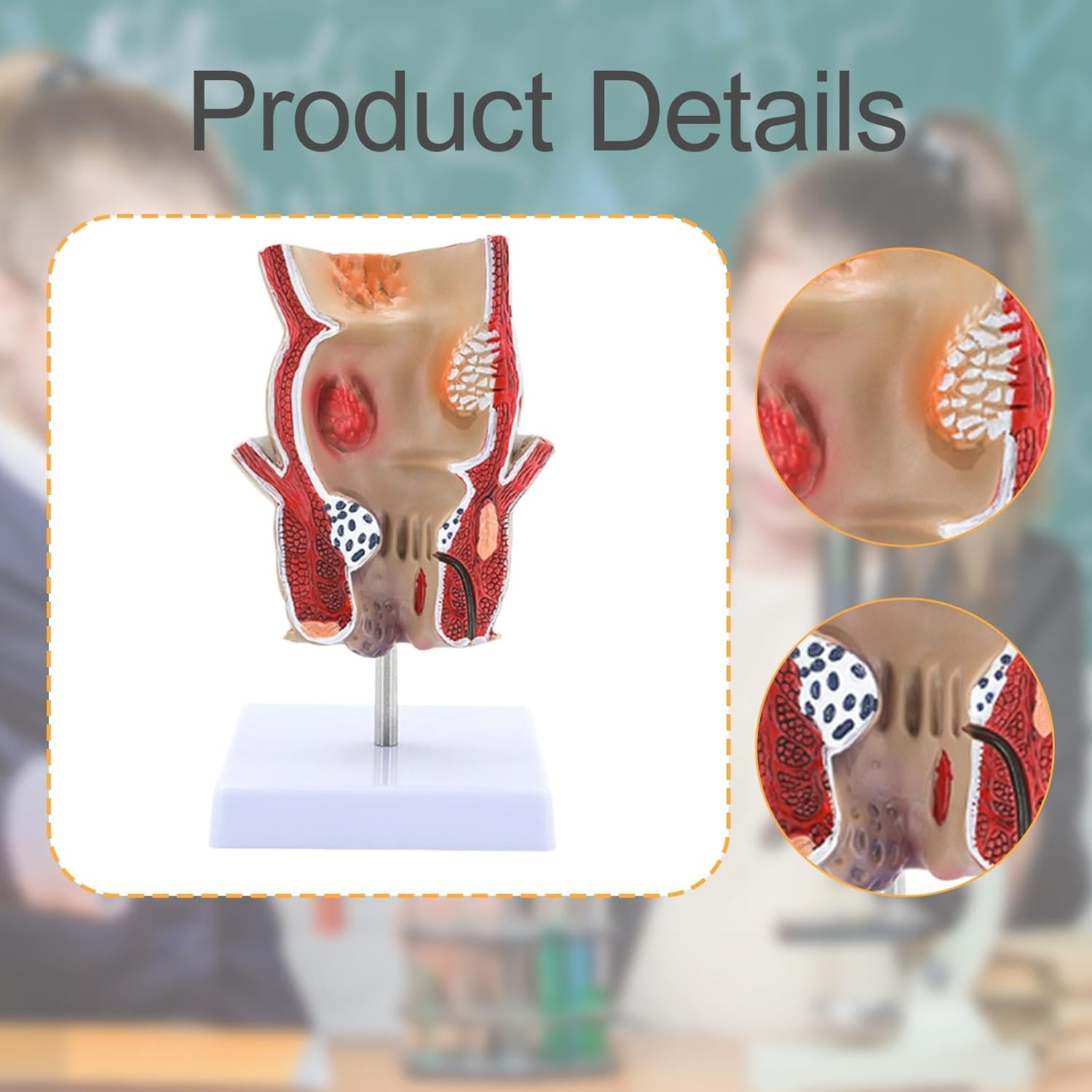 Eigell Human Pathology Rectal Model Educational Display Tool for Study School image number 2