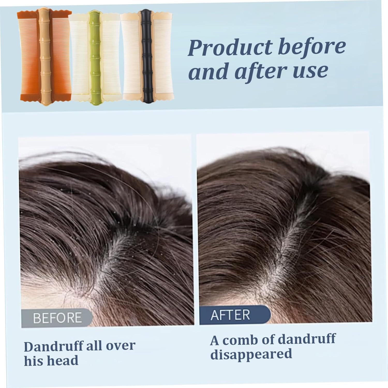 Dandruff Comb 3PCS PP Bamboo Styling Double-Sided Fine Teeth Lice Comb Thick Hair Flea Comb Comfortable Lice Brush for Kids Adults 4.9X2.8 Inch Lice Comb Head Lice Comb Flea Comb Lice Combs for Thick image number 1