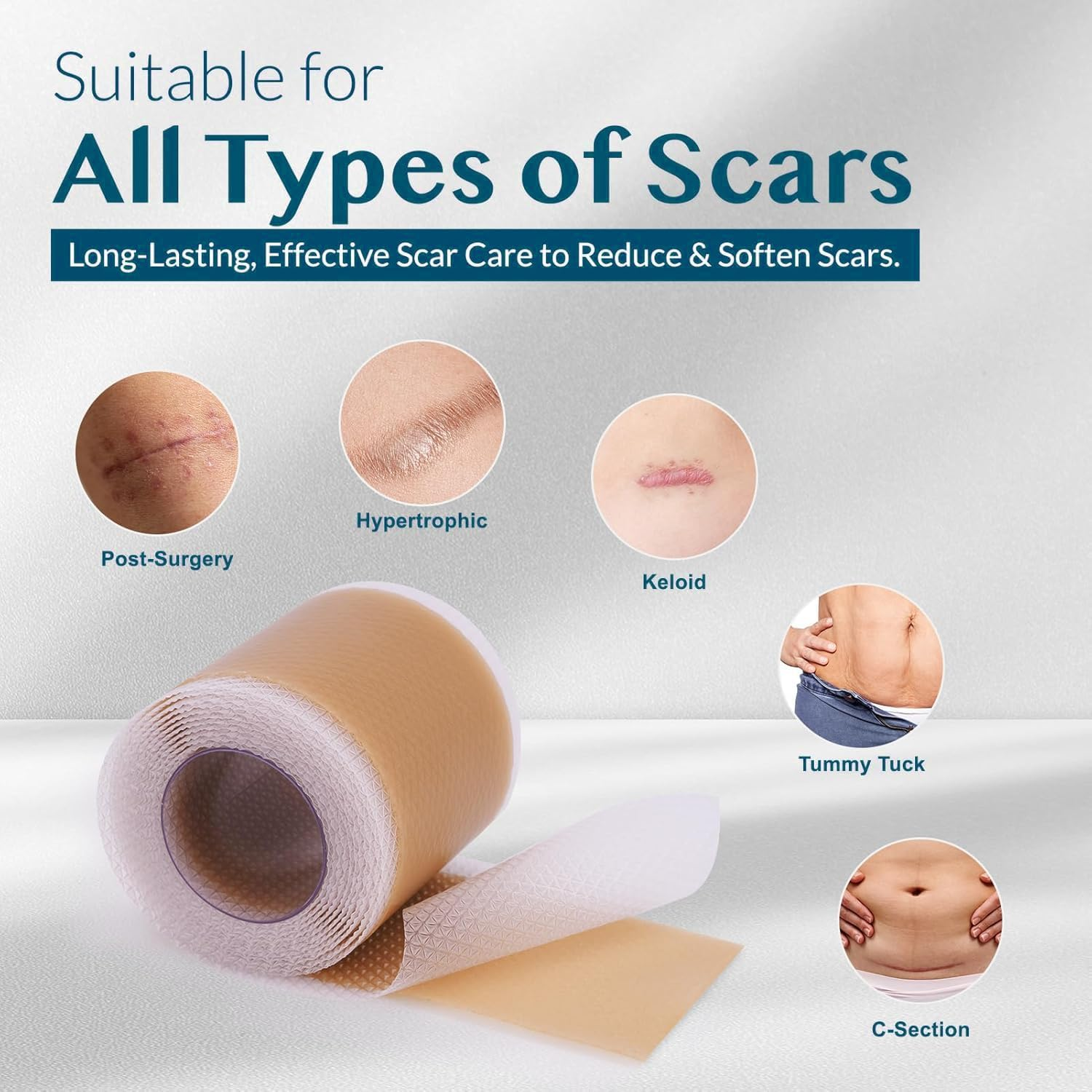 Silicone Scar Tape (4X300Cm Roll-3M), Silicone Scar Sheets, Scar Tape for Surgical Scars, Silicone Tape for Scars, Scar Sheets for Surgical Scars, C-Section, Tummy Tuck and Keloid image number 4