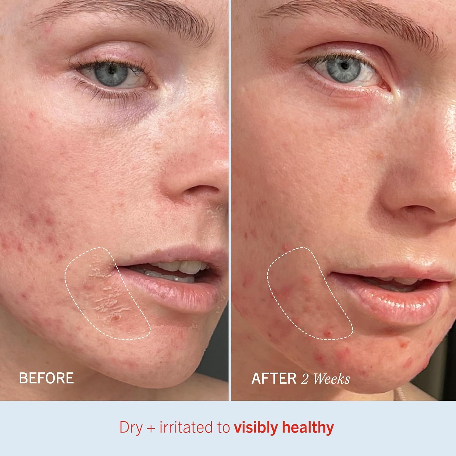 Ultra Repair Cream - 350Ml image number 1