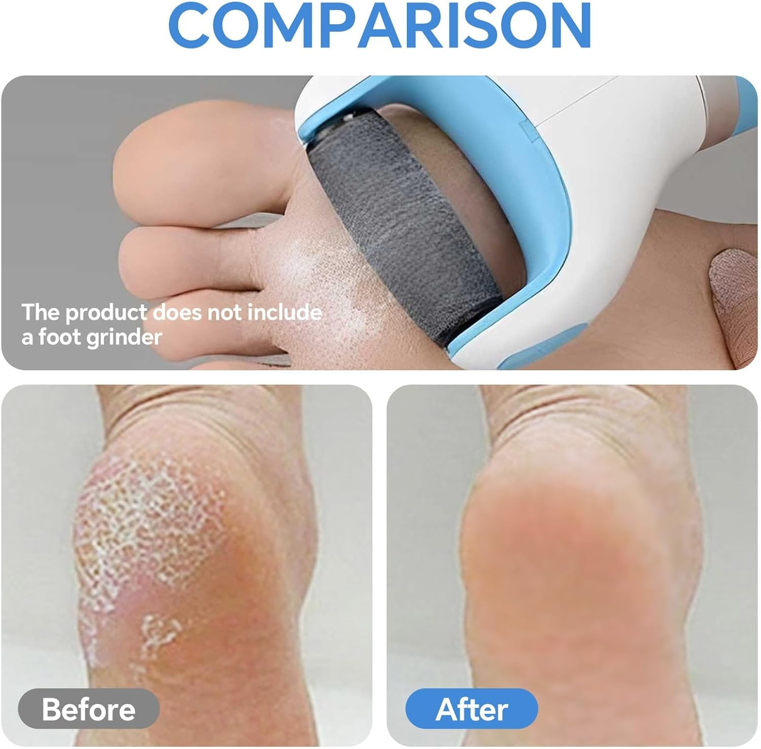 8 Pack Replacement Rollers Heads Refills Compatible with Scholl Velvet Smooth Replacement Roller Refill Hard Skin Remover Electronic Foot File Electric Pedicure Tools for Feet Black image number 2