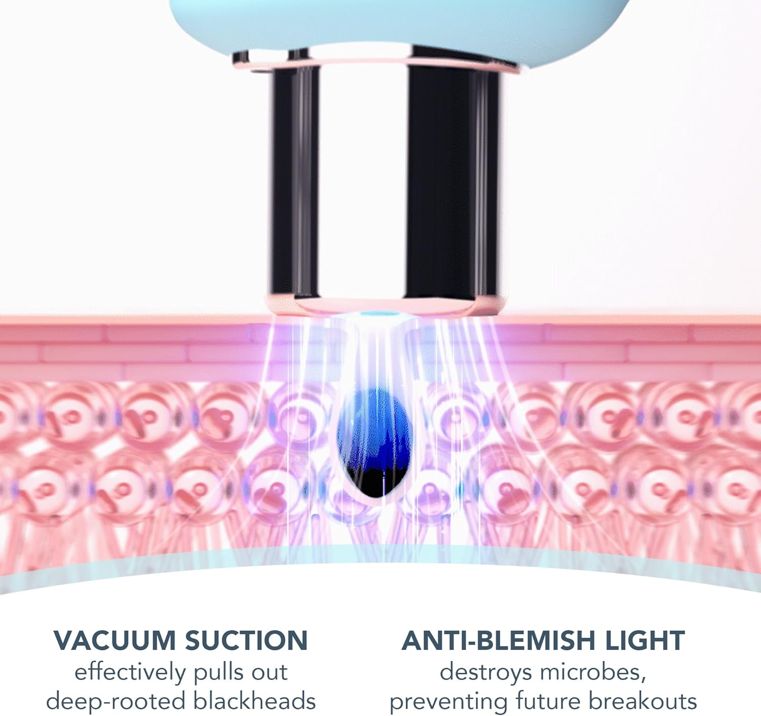 FOREO Blackheads Suck KIWI Bundle - Whitehead & Black Head Remover for Face + LUNA Micro-Foam Cleanser 2.0, 100 Ml - Vacuum Skin Care Tools - Blackhead Extractor for Face & Nose - No Pore Strips image number 1