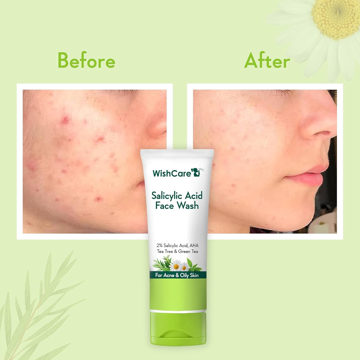 Wishcare 2% Salicylic Acid Face Wash with AHA, Greentea, Chamomile & Teatree - for Oil & Acne Control image number 1