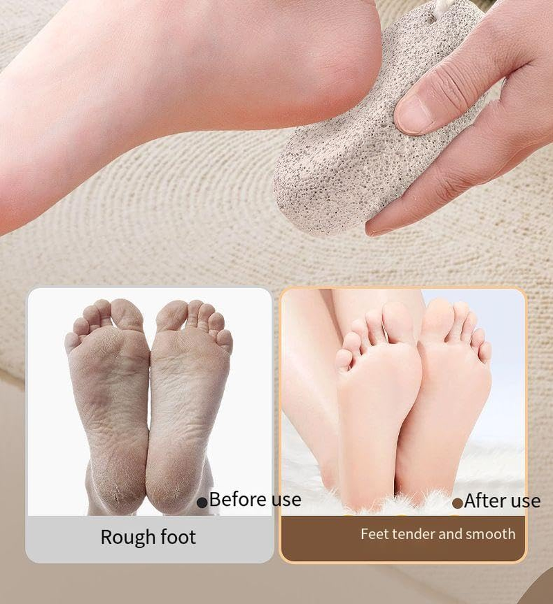 Volcanic Stone Grinding Foot Stone for Feet, 2-Pack Pedicure Tools Hard Skin Callus Remover for Feet and Hands (Grey, One Size) image number 3
