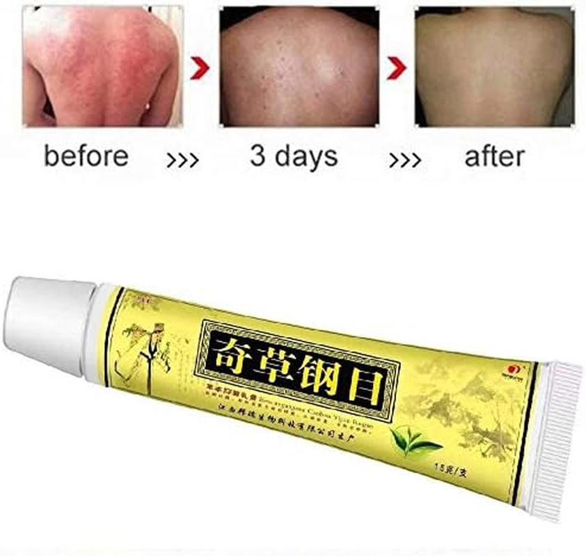 Chinese Herbal Eczema Cream, Anti-Itch Cream, Psoriasis Creams, Dermatitis and Eczema Pruritus Psoriasis, Natural Herbal Chinese Eczema Cream for Adults Kids (4PCS) image number 6