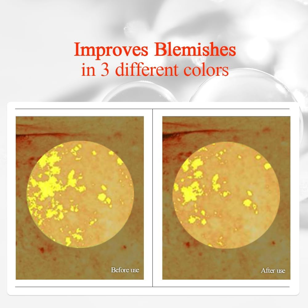 Pyunkang Yul Blemish Serum &ndash; Hydrating Serum for Dry Skin with Hyaluronic Acid, Niacinamide, Panthenol, Pearl Extract, 24-Hour Moisturizing and Elasticity Care, EWG Green (1.0 Fl. Oz, 30Ml) image number 1