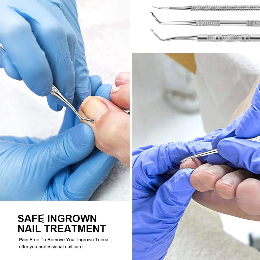 3Pcs Ingrown Toenail File and Lifters, [ Upgraded ] Teenitor Professional Surgical Safe Nail Treatment Pedicure Tool Kit under Nail Cleaner Tools Pain Relief image number 6