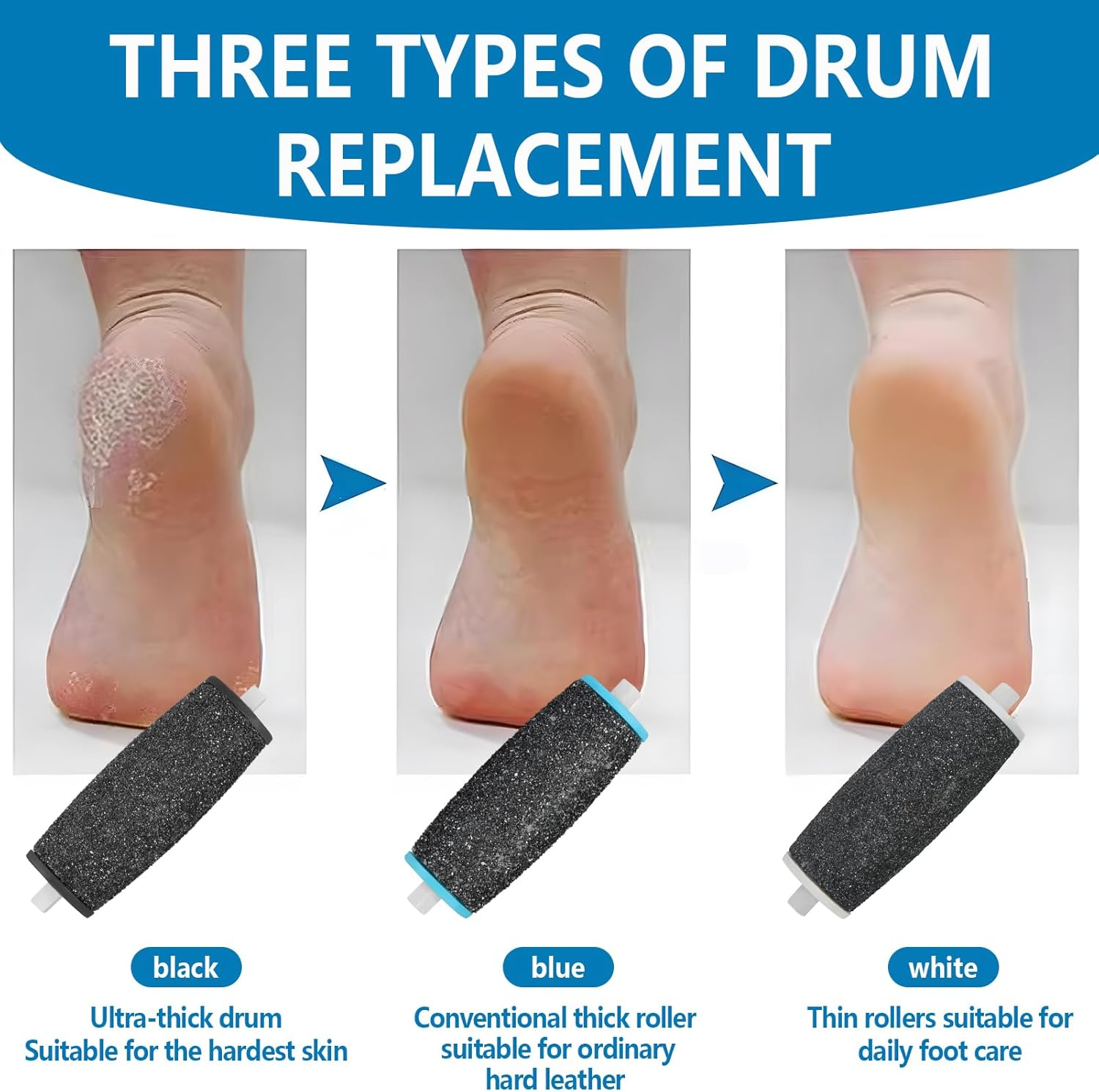 Pack of 10 Callus Remover Replacement Rollers, Replacement Rollers Compatible with Scholl Velvet Smooth, Includes 4 Extra Coarse 4 Coarse 2 Fine Replacement Heads, Pedicure Foot Care for Callus image number 2