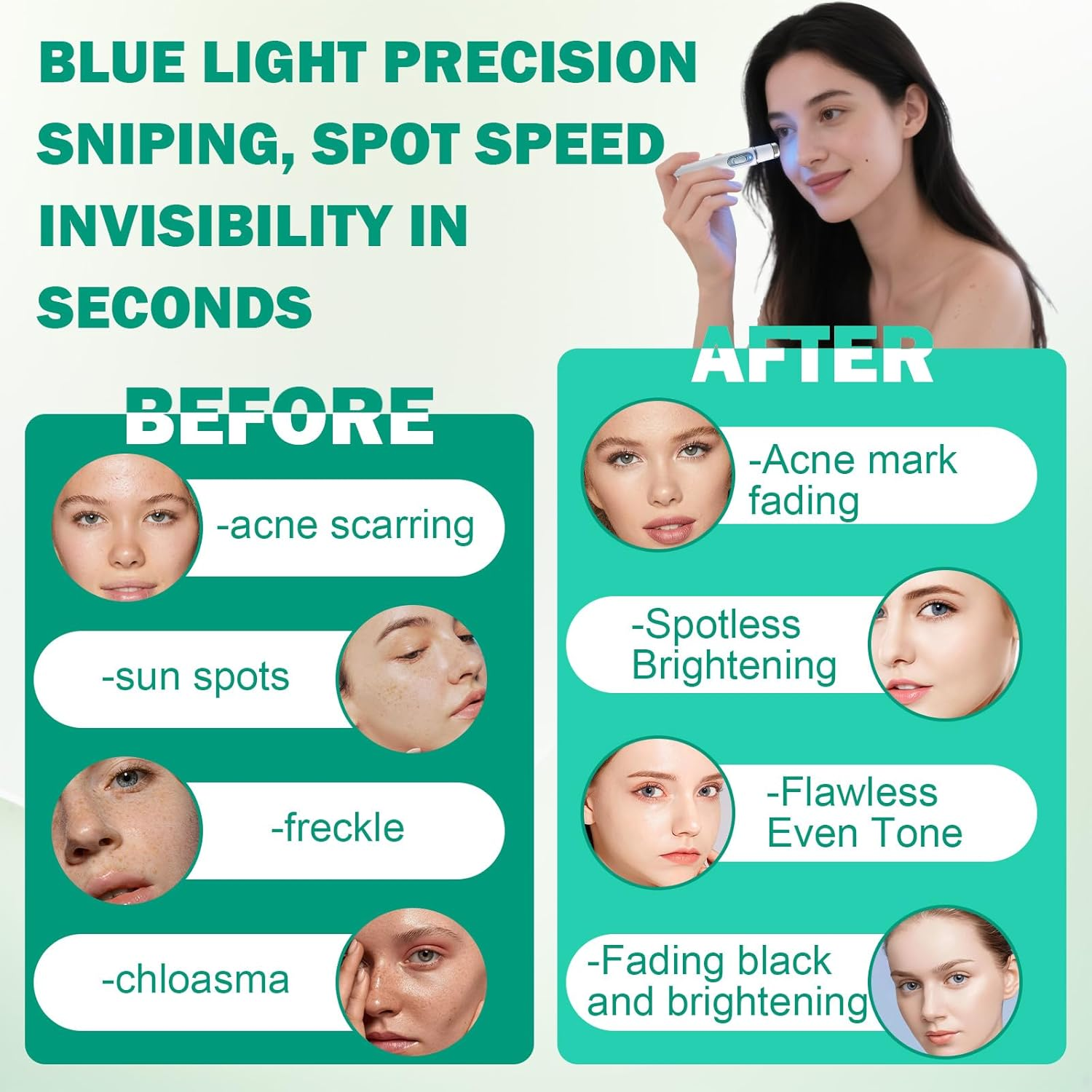 Non-Invasive Pen for Mole and Wart Removal, Blue Light Acne Remover, Wart Remover, Dark Spot Remover for Face and Body image number 5