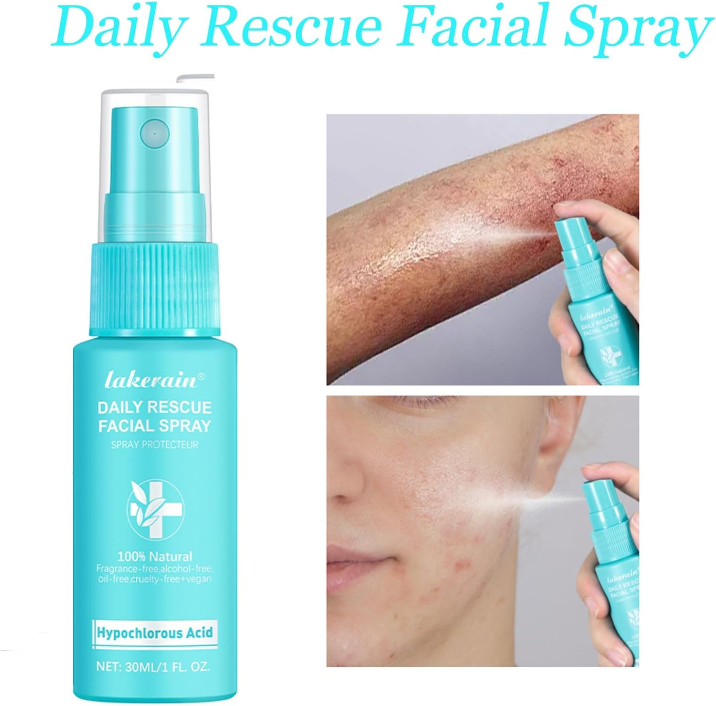 Hypochlorous Acid Face and Skin Spray,Safe for Use on Acne Prone Skin/Eczema/Dry Scalp/Post Procedure/Toner/Eye Lash/Face and Hand Cleanser image number 6