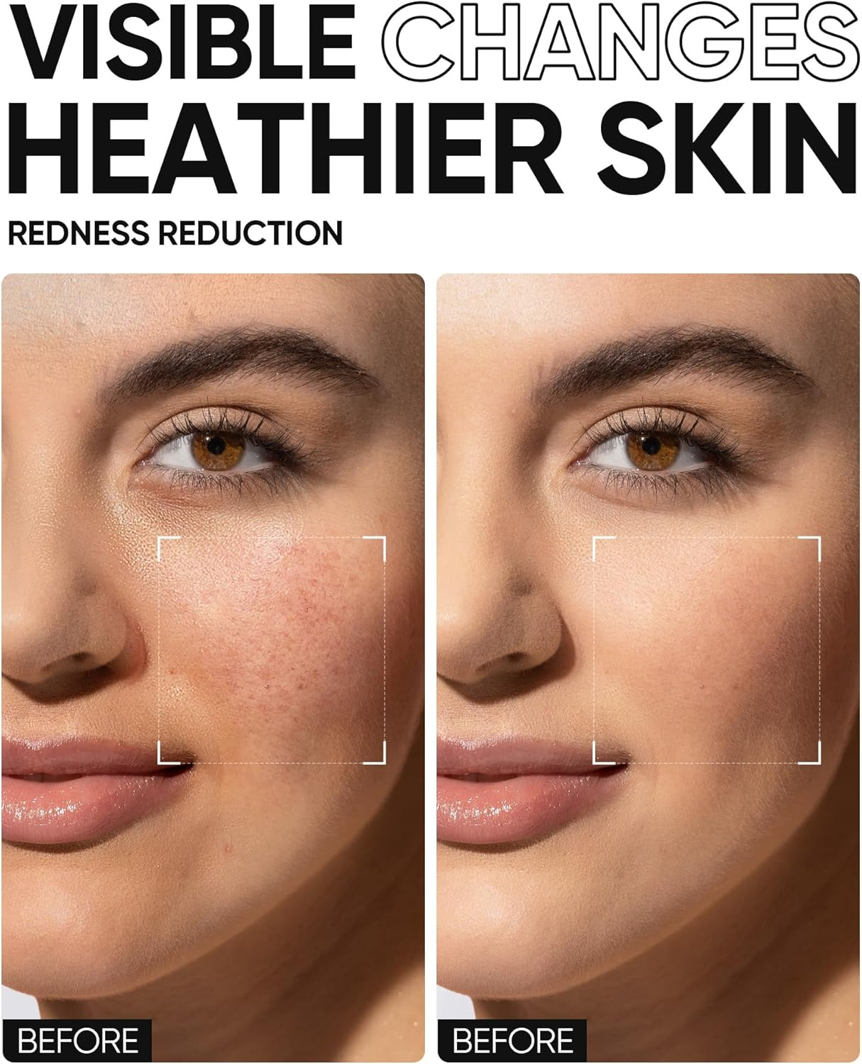 Skintific 5X Ceramide Barrier Moisture Gel 30Gr image number 2