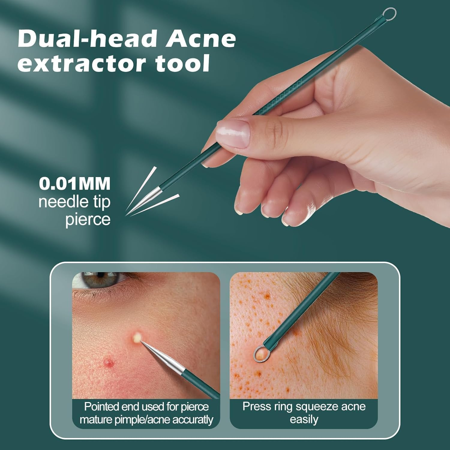 Upgrade Facial Blackhead Remover Tweezers, Ingrown Hair Tweezers,Extractor Acne Removal, Pimple Popper Tool Suit with Box (Green, 3Pieces/1Set) image number 2