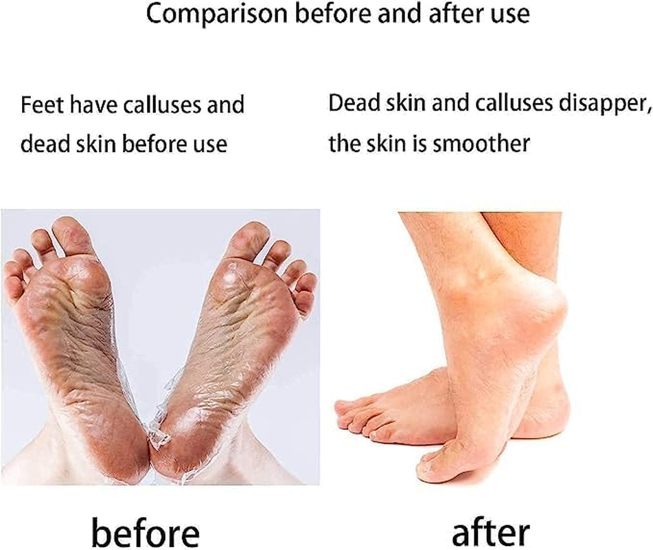 Professional Pedicure Tools Kit, LELYFIT Stainless Steel Foot File Aupplies Set, Nail Clippers, Foot Care, Callus Remover for Women and Men at Home or Travel (BLACK15) image number 2