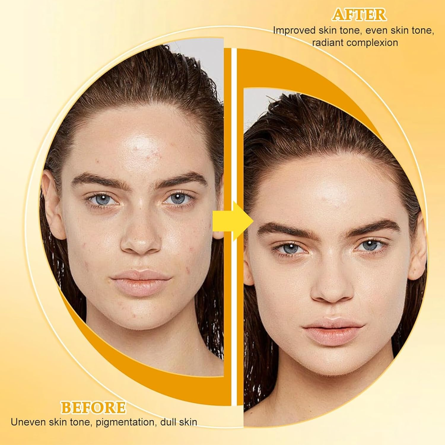 Natural Turmeric Soap, Kojic Acid & Turmeric Soap, Kojic Acid Lemon Soap Bar, Acne, Dark Spots, Hyperpigmentation & Smooth Skin, Brightening, Deep Cleansing, Refreshing, Moisturizing