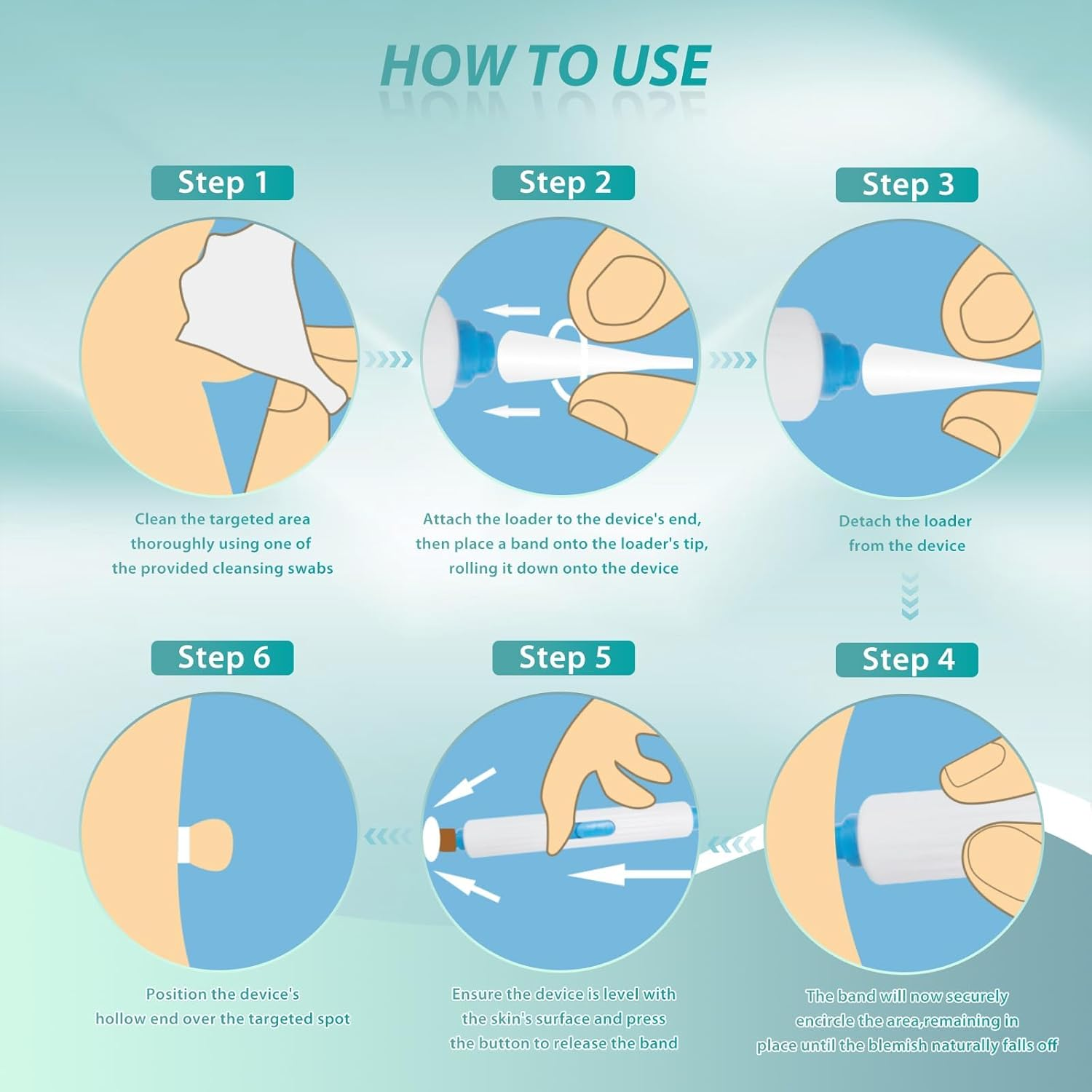 Skin Removal Kit, for the Removal of Skin Tags and Warts, Safe and Effective to Be Used at Home