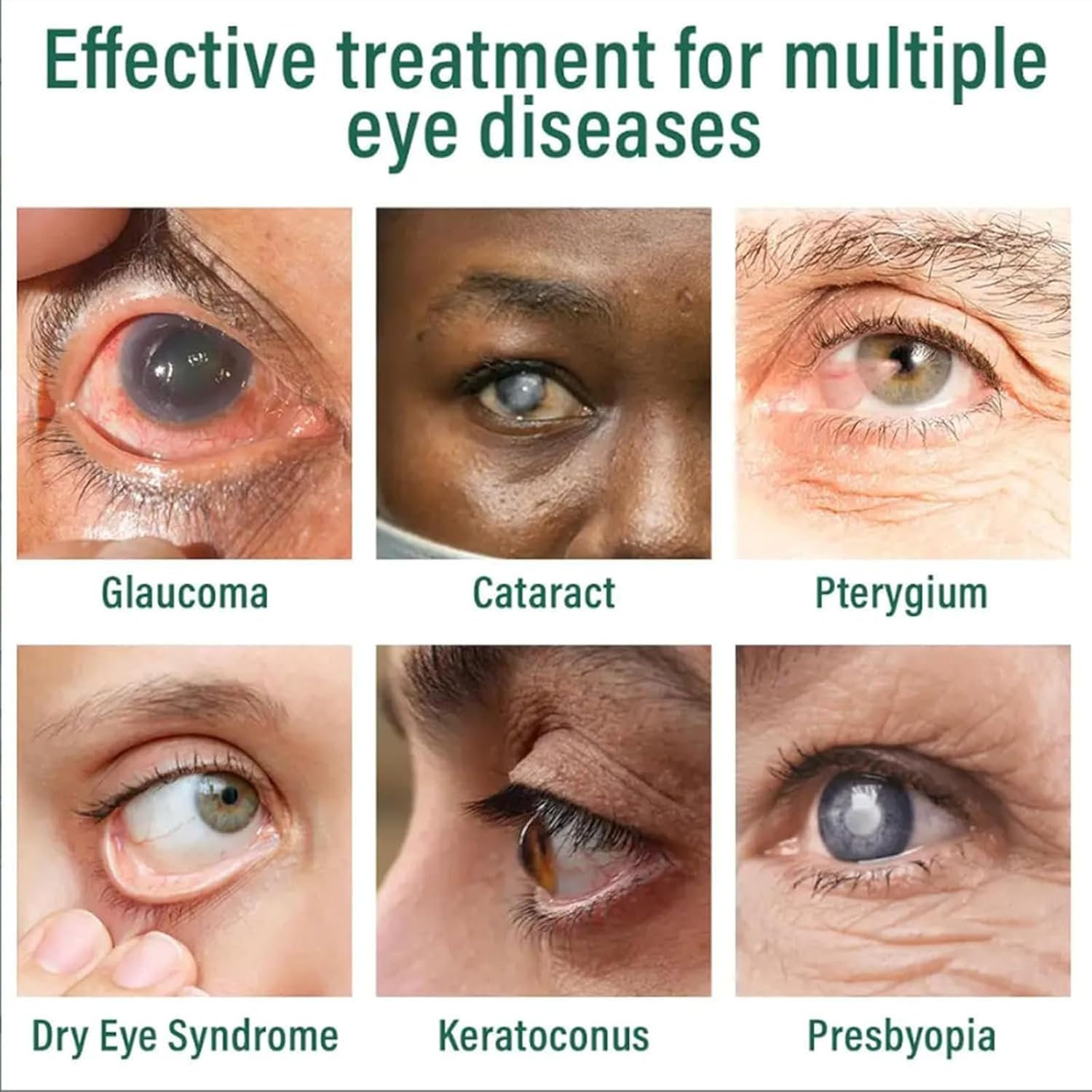 Nano Eye Drops Serum, Natural Lubricant Eye Drops for Dry Eyes, Relieves Symptoms of Presbyopia, Tired, Stressed & Moisturizing (3Pcs) image number 5