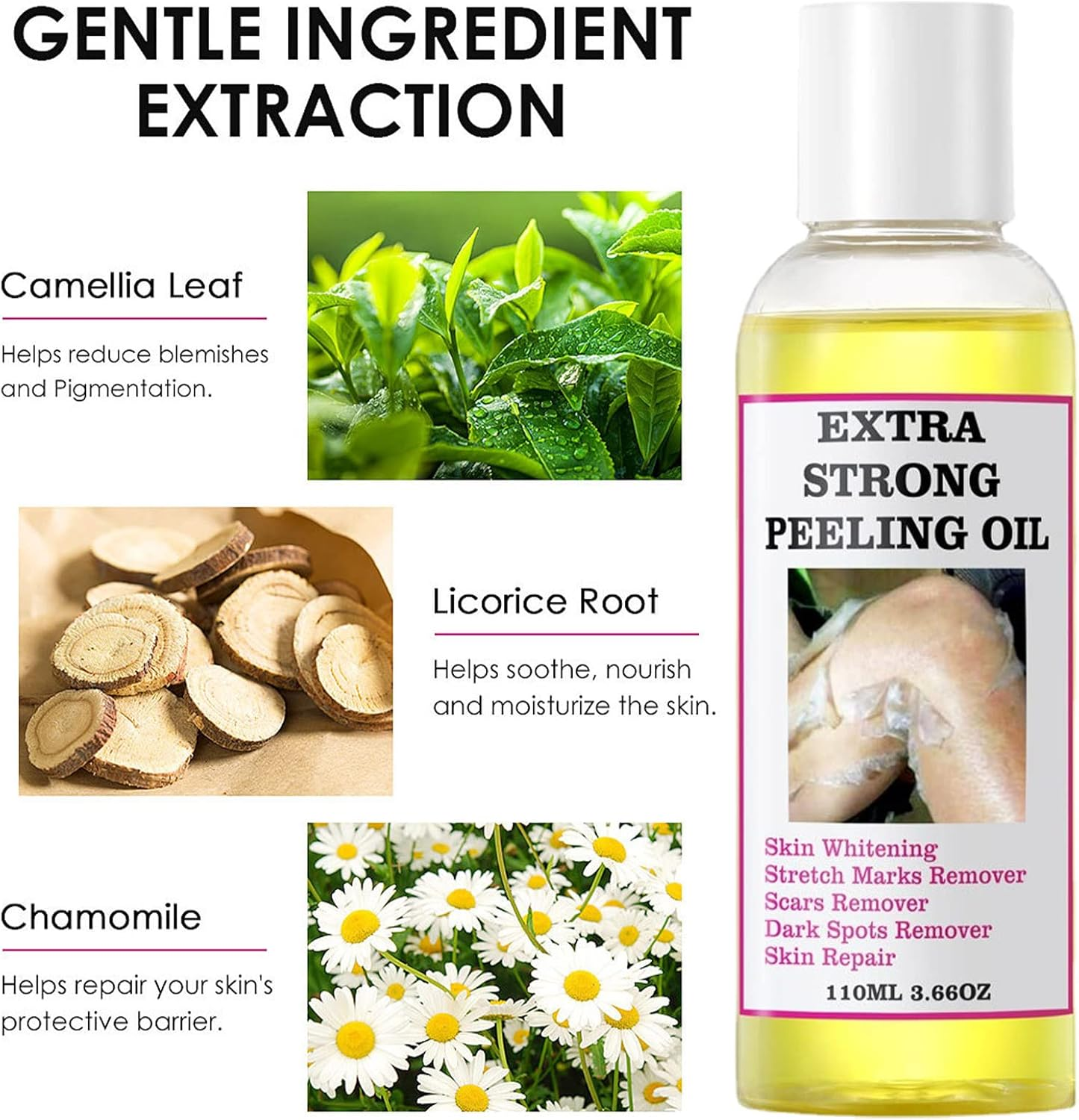 2 Skin Peeling Exfoliator | 110Ml Portable Effective Yellow Peeling Oil, Skin Peeling Solution Multi-Use Spot Correcting and Brightening Oil for Elbows, Knees, Fingers Puchen - 2 Pcs 110Ml image number 4