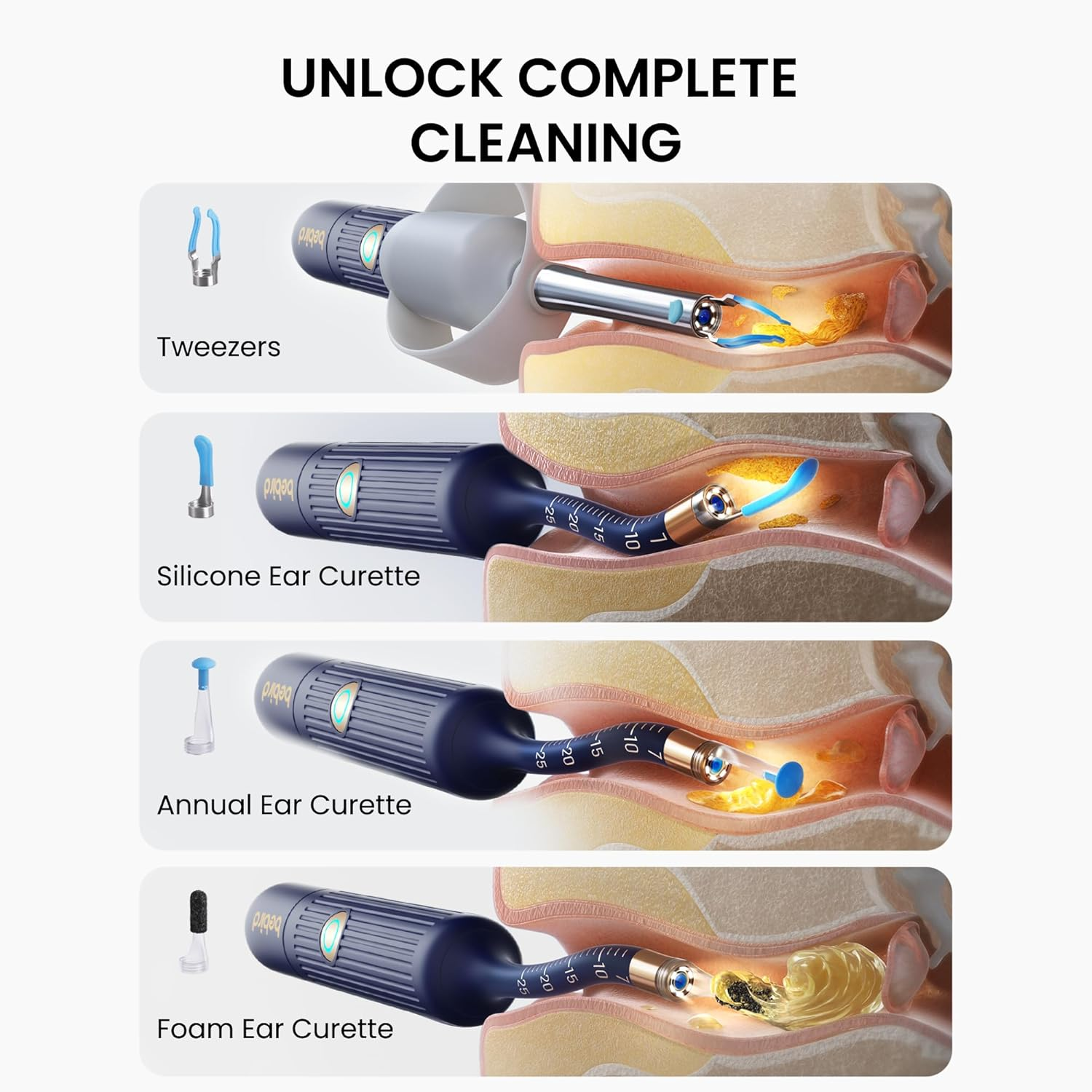Bebird Earwax Remover, Earsight plus Otoscope,Flexible Ear Scope Otoscope Camera Light 1920P Hd,Ear Cleaner with Portable Case for Adults,Kids,Ios,Android（Dark Blue）
