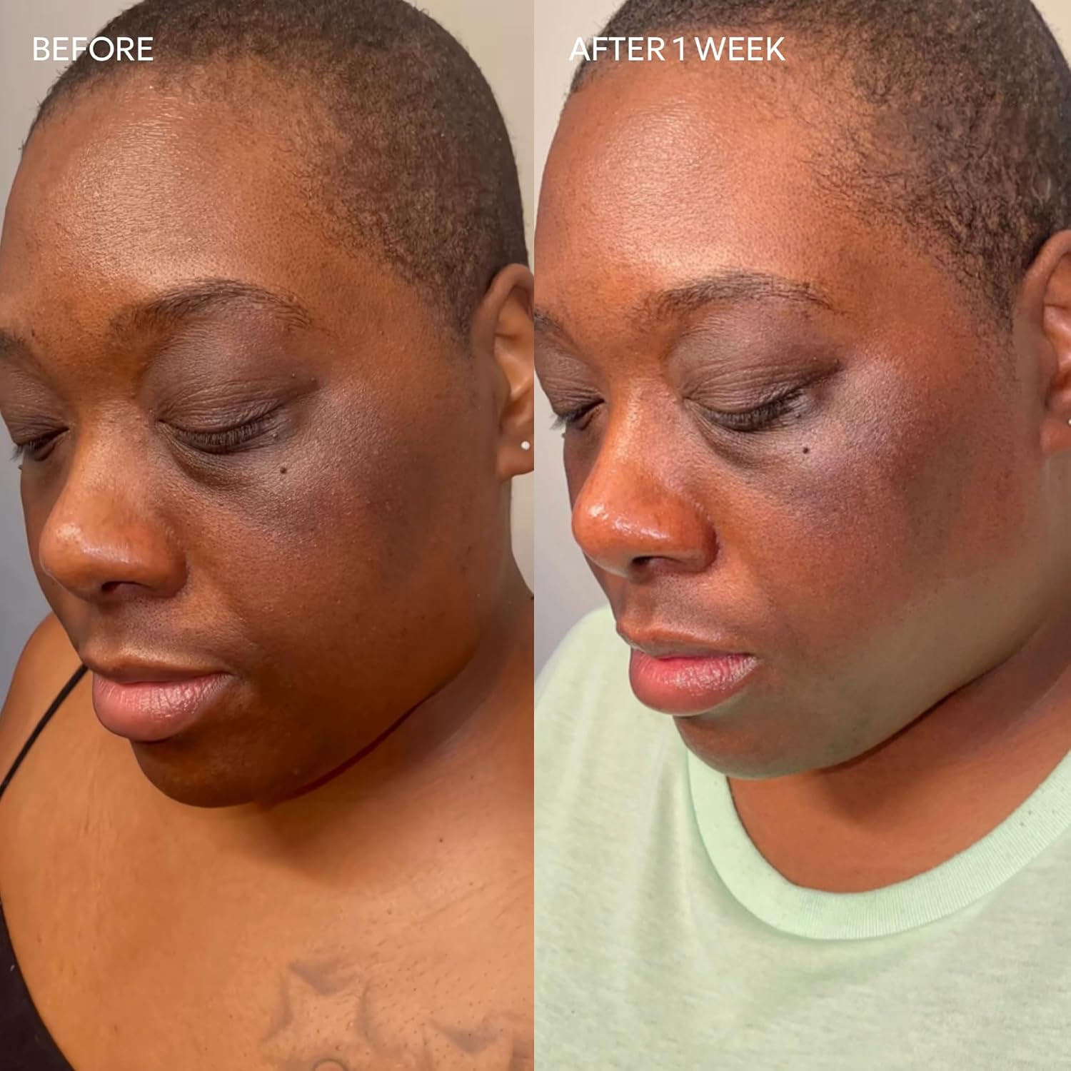 Dermisa Brightening Bar Soap, Natural Botanical Extracts, (3-Pack, Each of 3 Oz)