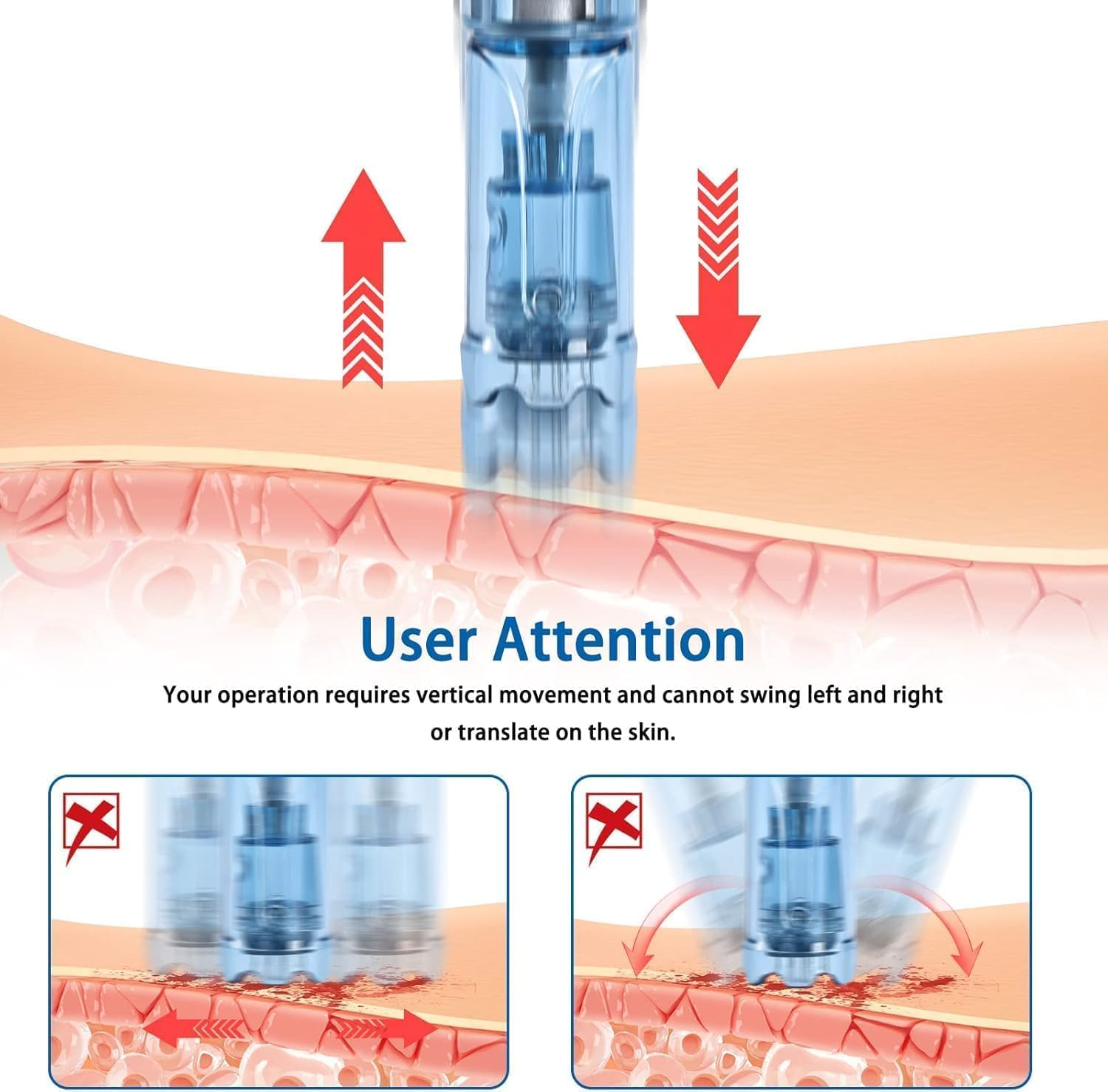 Wesileyern 20Pcs 12PIN Replacement Cartridges Needles, Dermapen Microneedling Needles, Professional Dermapen M8S/A9/ A11 Wireless Derma Roller Pen Needles, for Dermapen M8S/A9/ A11