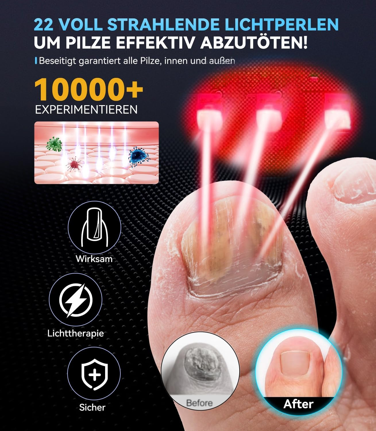 Nail Pil Laser Device, 7 Days Fast Acting, with Time Display, Nail Pil Laser Device, 365 Nm Infrared Light, 405 Nm Blue Nail for Fingers and Toenails (White) image number 3