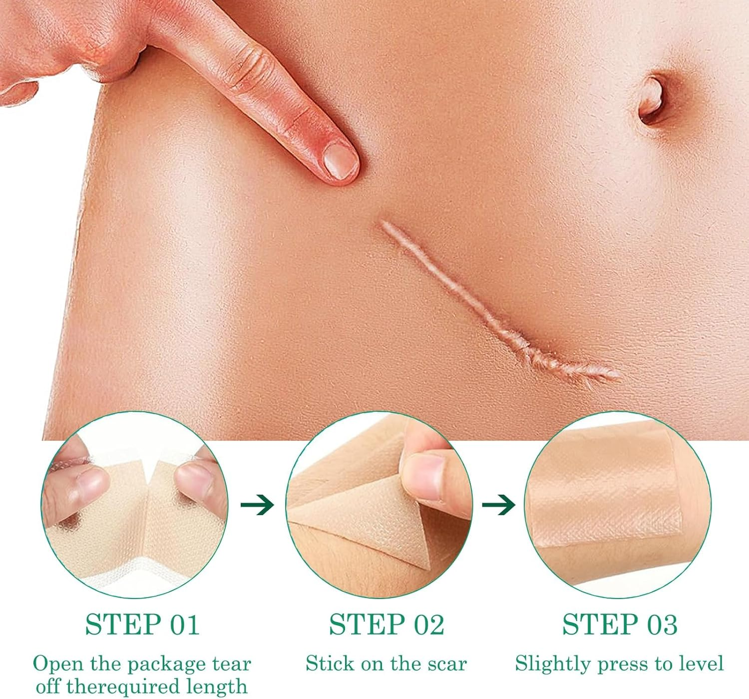 Silicone Scar Tape, 2 Pcs Silicone Scar Sheets, Soft Silicone Tape, Hydrocolloid Bandages for C-Section, Surgery, Burn, Keloid, Acne Et, Easy Tear Reusable Scar Removal Sheet (1.6 &times; 60 Inch) image number 2