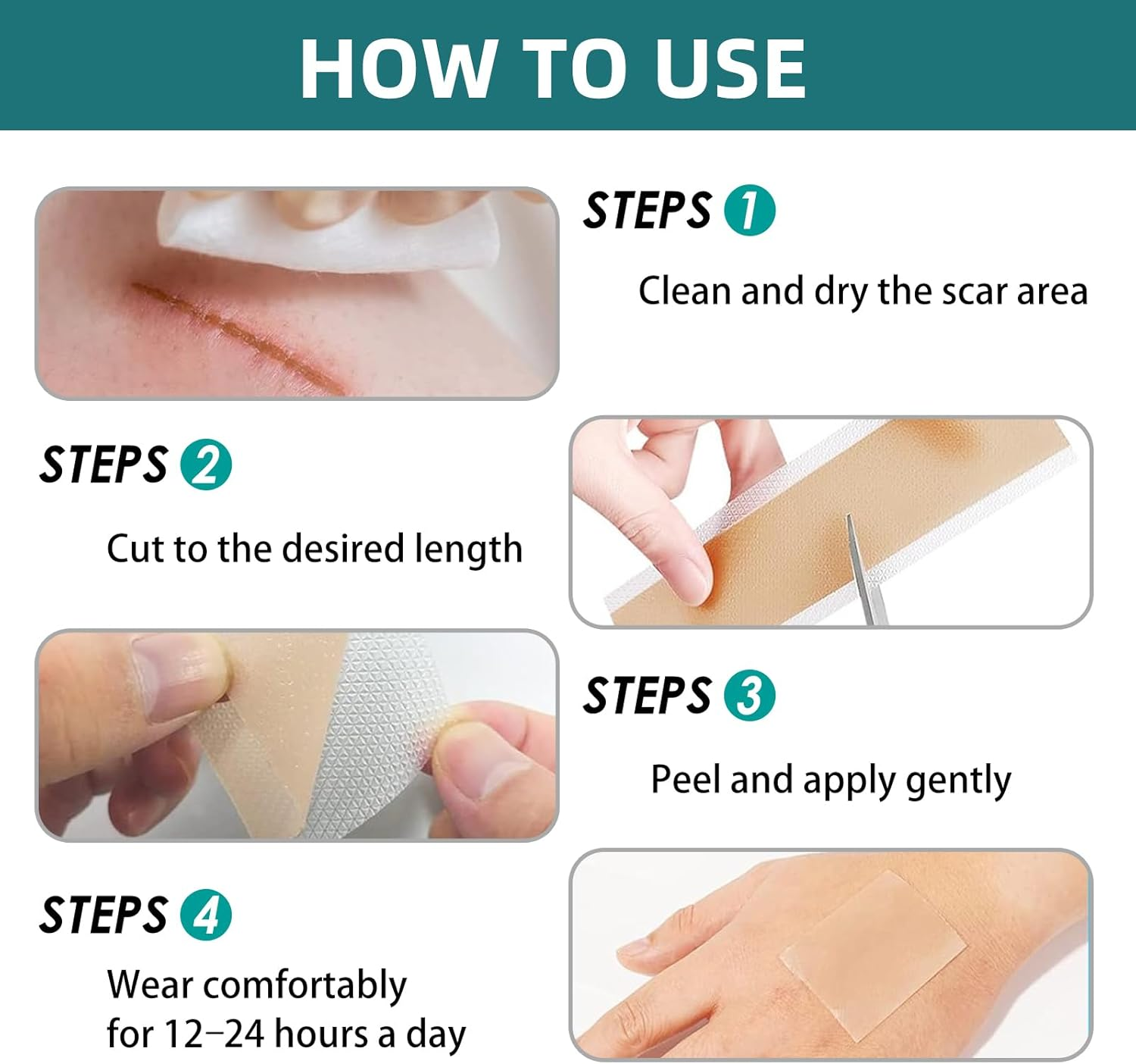 Silicone Scar Tape for Surgical Scars: 3 Meters Scar Gel Sheets for C-Section Tummy Tuck Recovery and Treatment &ndash; Reusable Scar Strips for Keloid Burn Scars Removal (1.6'' X 120'' Roll-3M)