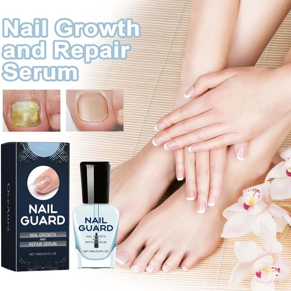Onyxoguard Nail Growth and Repair Serum,Natural Formula Nail Serum Nail Growth Oil,Nail Growth and Repair Serum (2Pcs) image number 2
