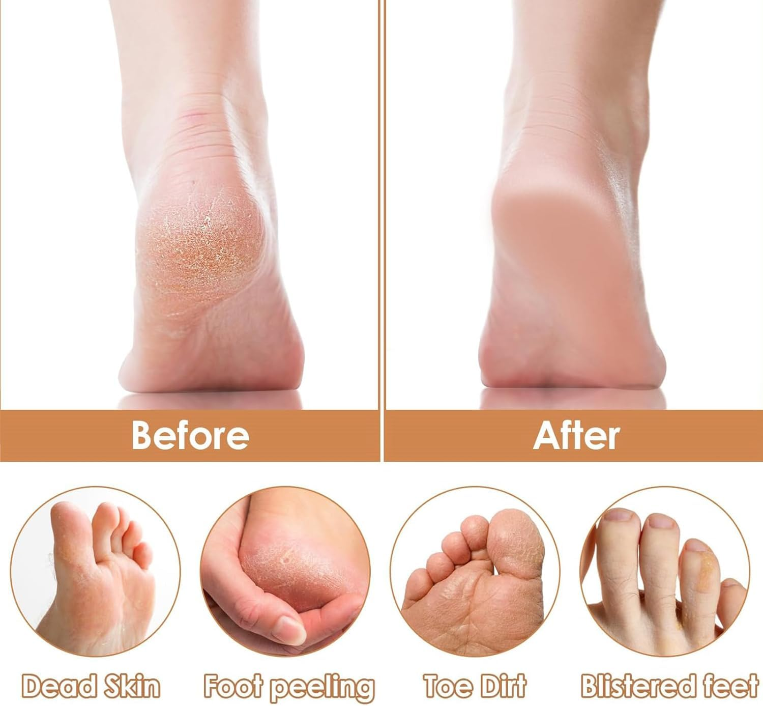 Pumice Stone Foot Pedicure File，Foot File Pumice Stone, with Wooden Handle Foot Grater for Foot Cracked Heels, Dead Skin, Hard Skin- Premium Beech Wood & Silicon(Black) image number 5