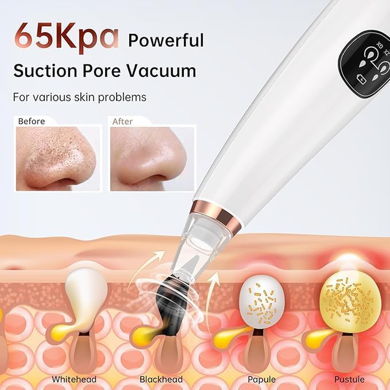 Frafuo Blackhead Remover Pore Vacuum, Facial Pore Cleaner with 3 Adjustable Suction Levels, 6 Probes, USB Rechargeable Blackhead Extractor Tools for Women & Men image number 1