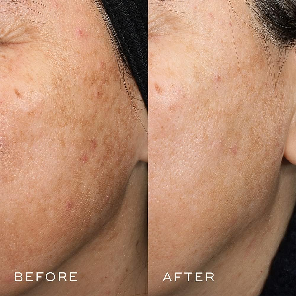 Medik8 Crystal Retinal 6 Stable Retinal Night Serum with Super Strength Vitamin a for Skin Ageing 30Ml image number 6