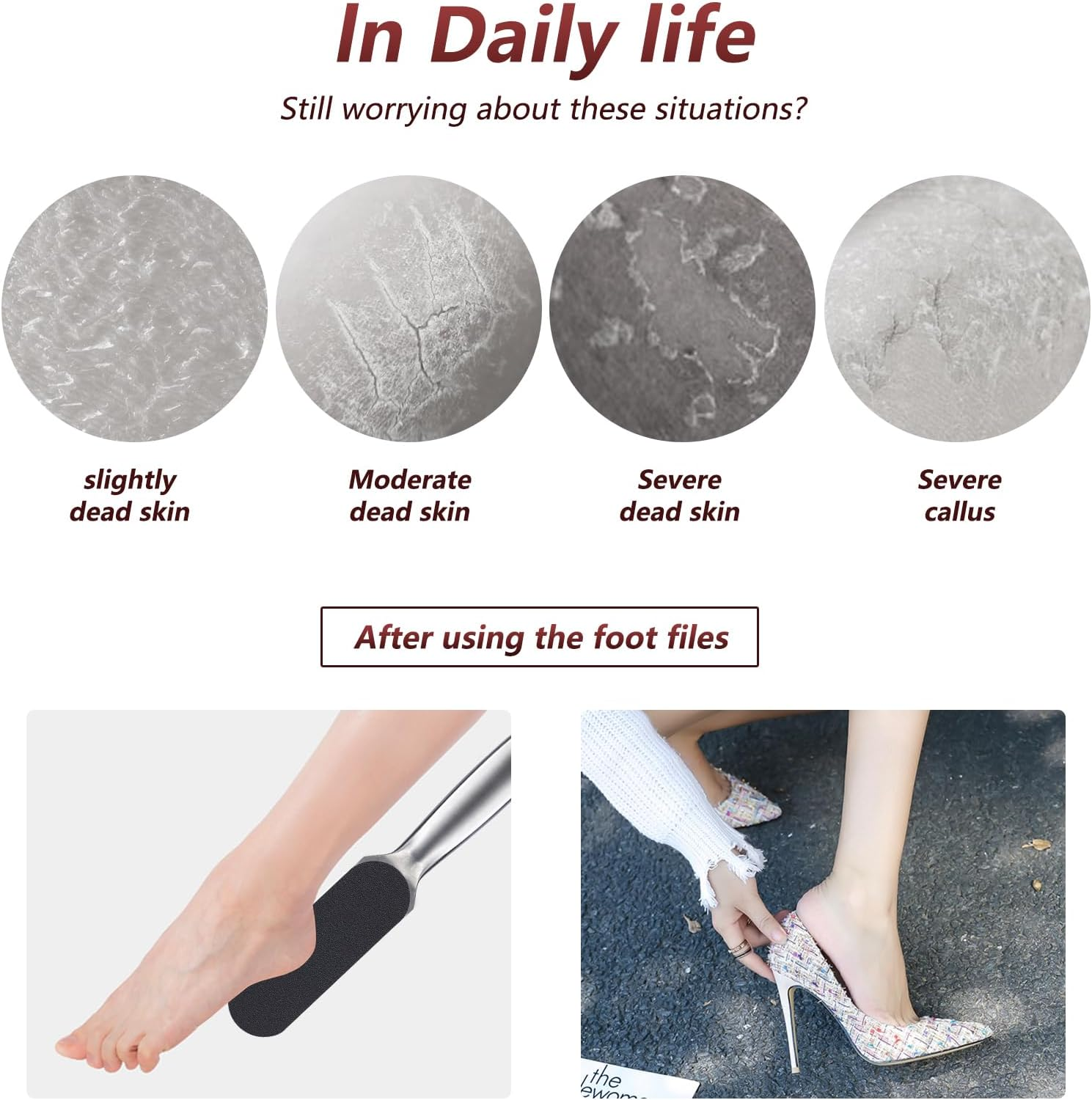 BNG Foot File Set, 40 Pieces Replacement Sandpaper Refill Pads, Pedicure Tool for Stainless Steel Foot Rasp, Hard, Cracked Heel, Dead Skin, Cuticle, Callus Remover, #180 image number 2