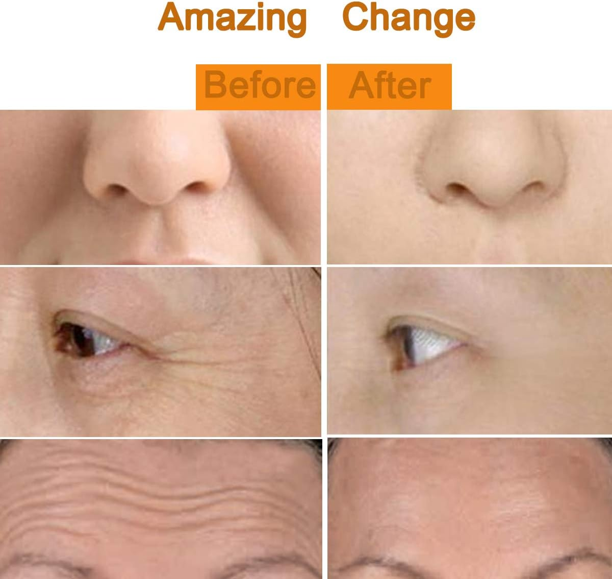 2-IN-1 Beauty Bar 24K Golden Pulse Facial Face Massager,Electric 3D Roller and T Shape Arm Eye Nose Head Massager Instant Face Lift,Anti-Wrinkles,Skin Tightening,Face Firming Roller image number 3