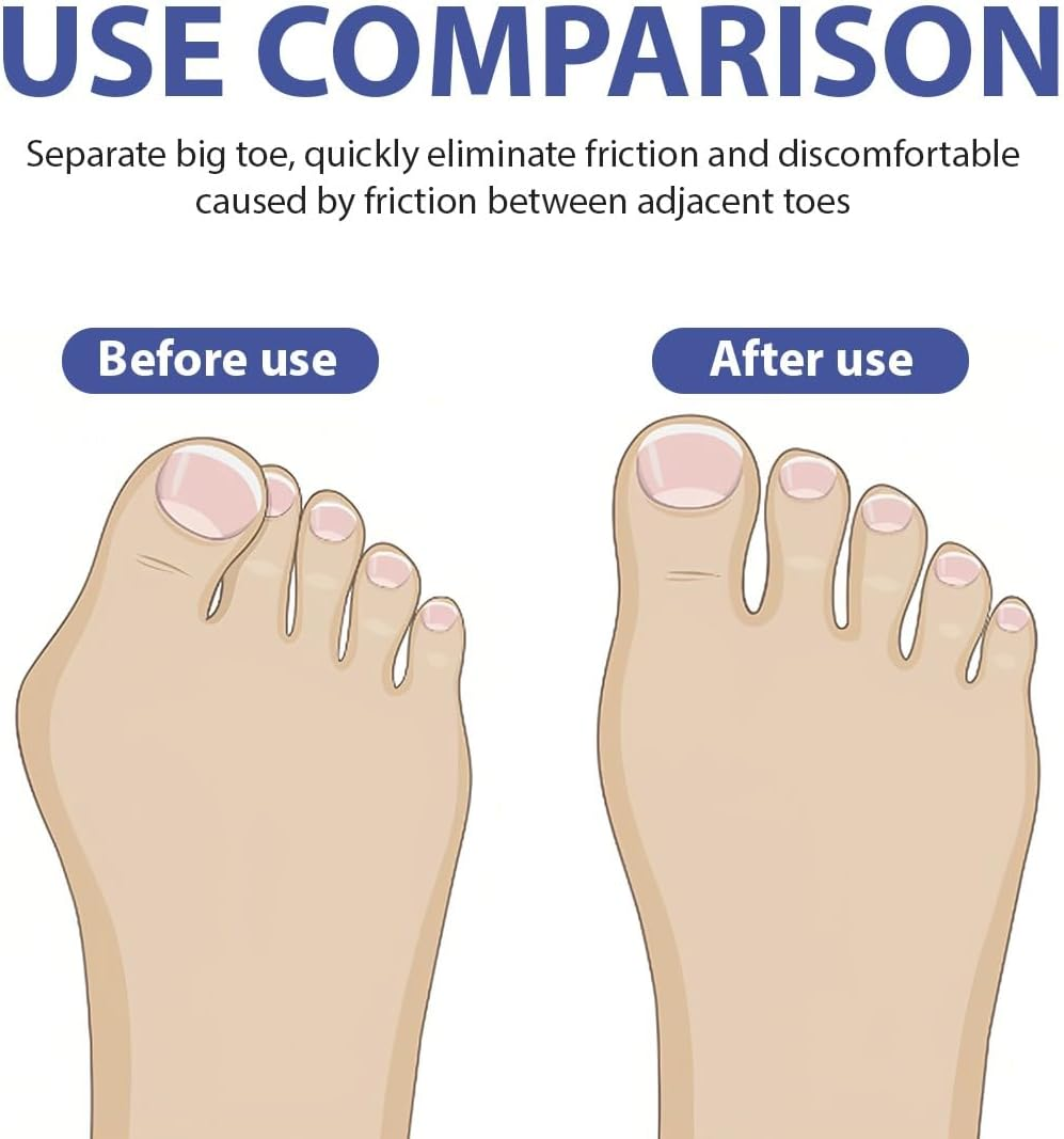 JYNXOR Hammer Toe Correction, 4 Pairs of Hammer Toe Cushions, Hammer Toe Pad Correctors, Silicone Toe Wavy Corrector, for Reduces Pain and Friction, for Men and Women image number 5