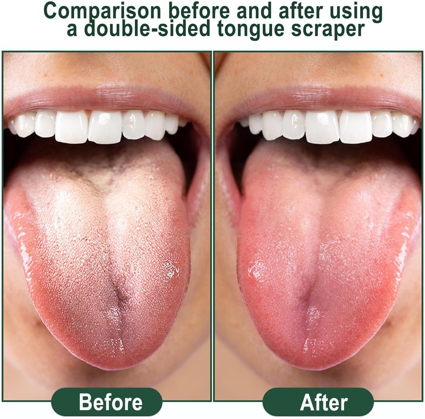 Tongue Scraper | Fresher Tongue Tools Healthy Oral Hygiene Brushes | Healthy Oral Hygiene Brushes Silicone Dentals Tongue Scraper for Fresher Breath Puchen image number 4