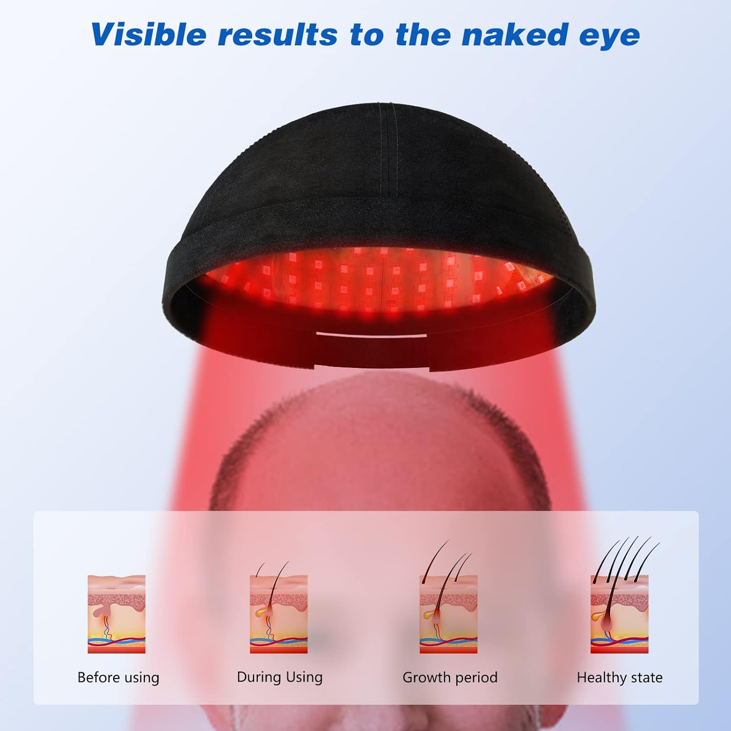 KTS Red Light Therapy Hair Growth Helmet, 236 Diodes Hair Growth Cape, FDA Cleared Hair Growth Device, Hair Loss Treatment for Men and Women Thinning Hair, Restore Hair Thickness image number 4