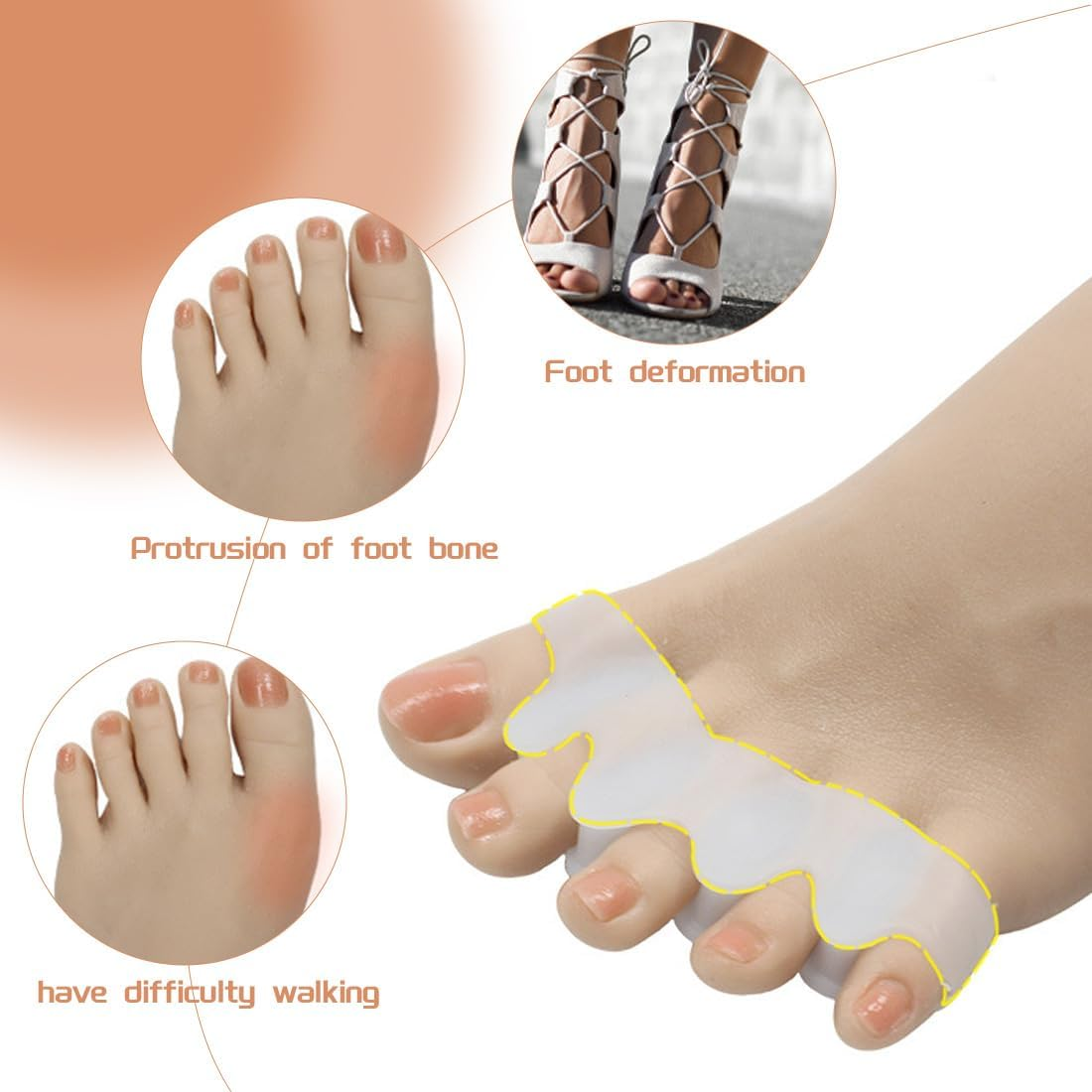 IEBTAWN 4 Pairs of Gel Toe Separators for Overlapping Toes, Toe Spacer, Silicone Toe Separator, Hallux Valgus, Correction of Bunions, Toe Separator, to Relieve Bunions, Hammer Toes, Hallux Valgus image number 2