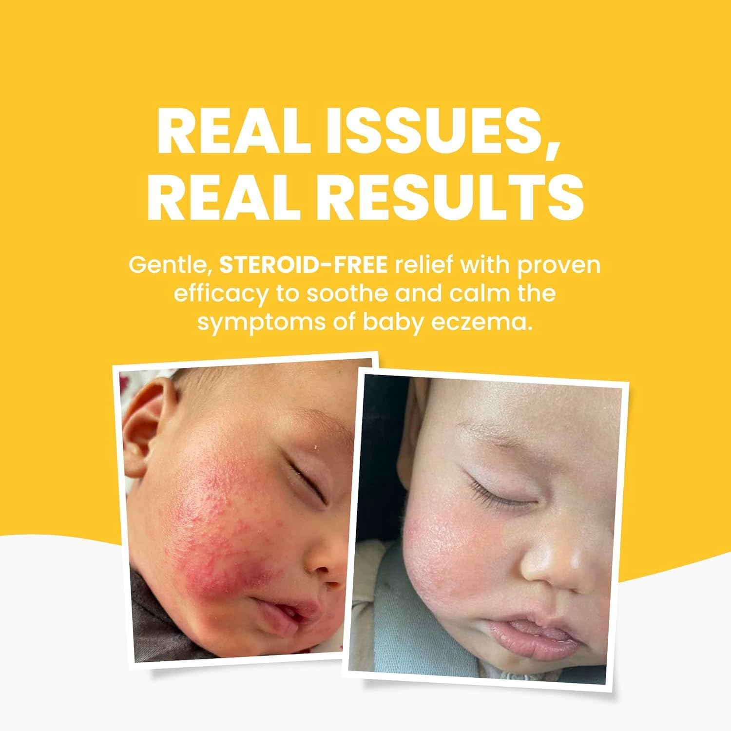 Grahams Natural Eczema Cream for Babies and Children 150 G, 150 Grams image number 1