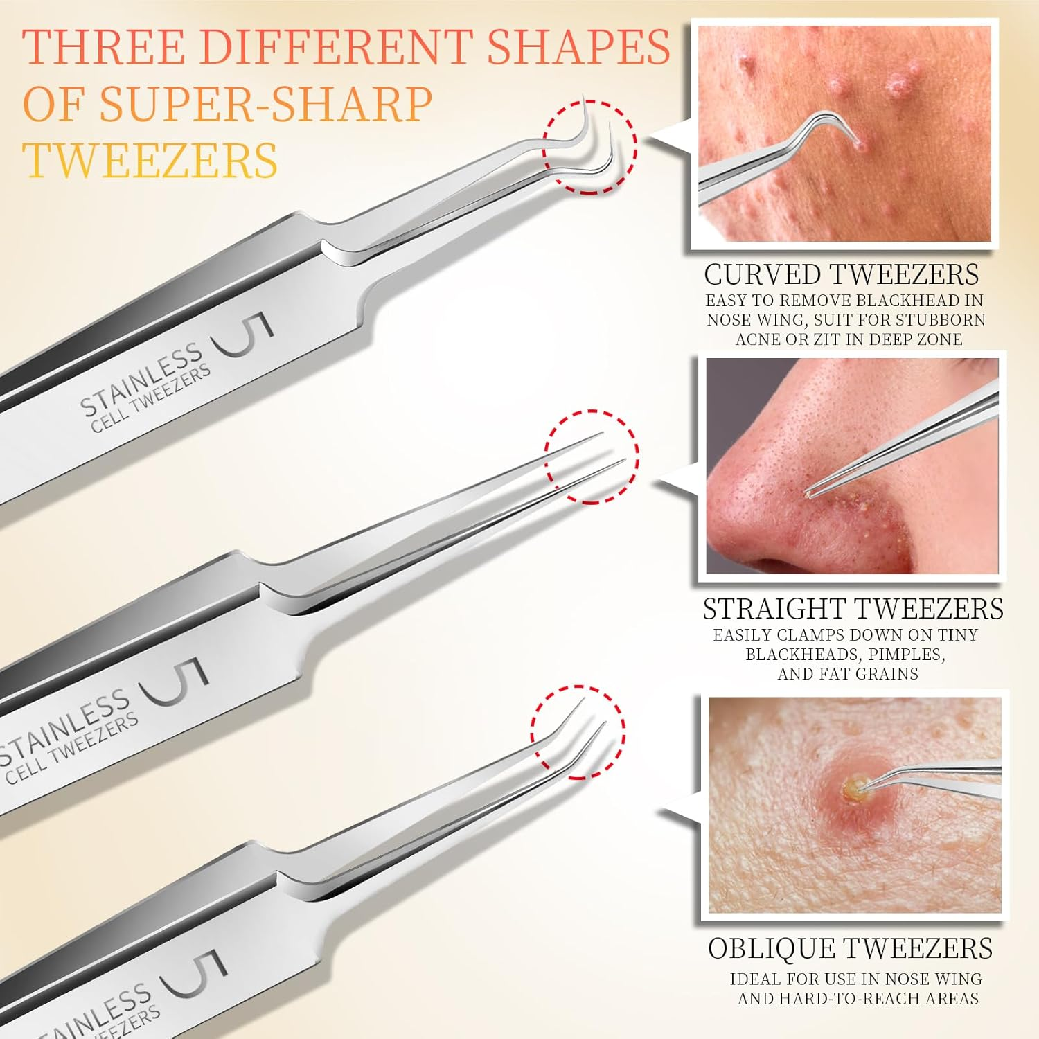 Teenitor 4 Pcs Professional Blackhead Tweezers and Pimple Popper Tool Kit, Stainless Steel Cell Tweezers for Blackhead, Pimple, Whitehead, Ance image number 1