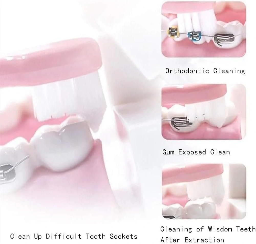 Interdental Brush with Small Head for Braces and Tight Teeth, Precision Cleaning Tuft Toothbrush for Sensitive Gums (4-Pack)- Ruibex image number 1