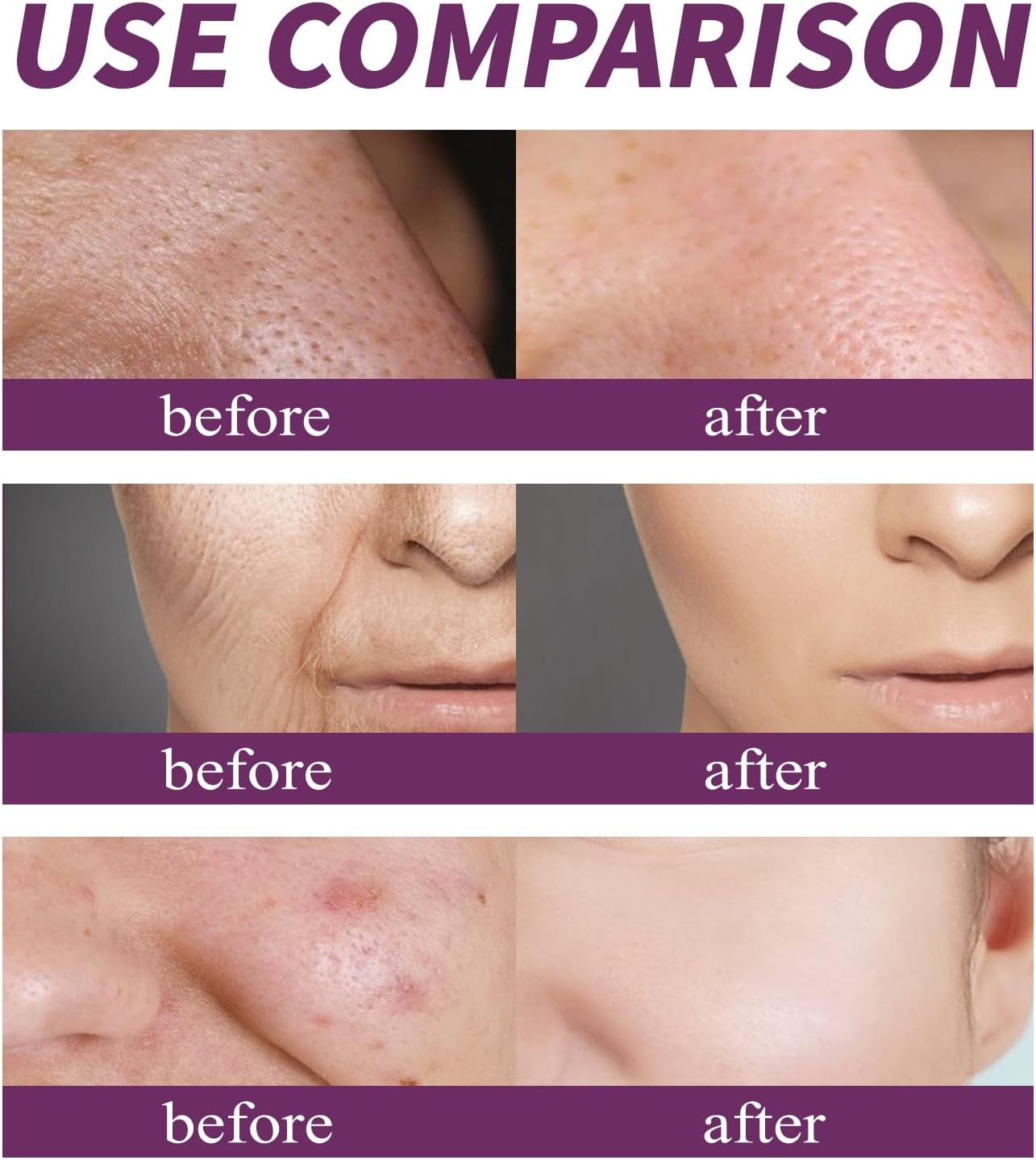 Niacinamide 20% Serum, Deeply Nourishes, Shrinks Pores, Spot-Lightening Skin Care Essence, Whitening and Brightening, Anti-Aging Serum for Face, Reduce Fine Lines, for All Skin Types (1Pcs) - 2Pcs image number 4