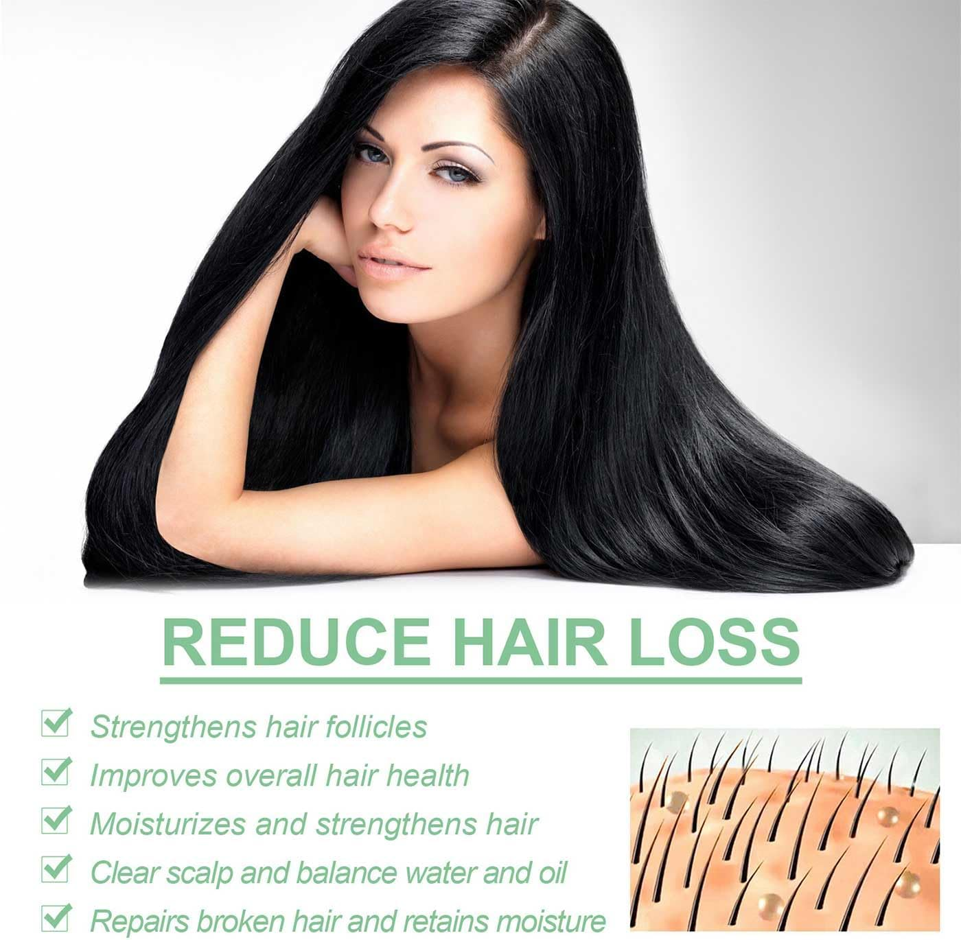 Renewhairx - Renew Hair X Roll-On Hair,Hair and Beard Regrowth,Roll-On Hair Growth Oil,Hair Growth Serum,Anti-Hair Loss Essential Oil,Hair and Beard Regrowth Roll on Serum for Women Men image number 3