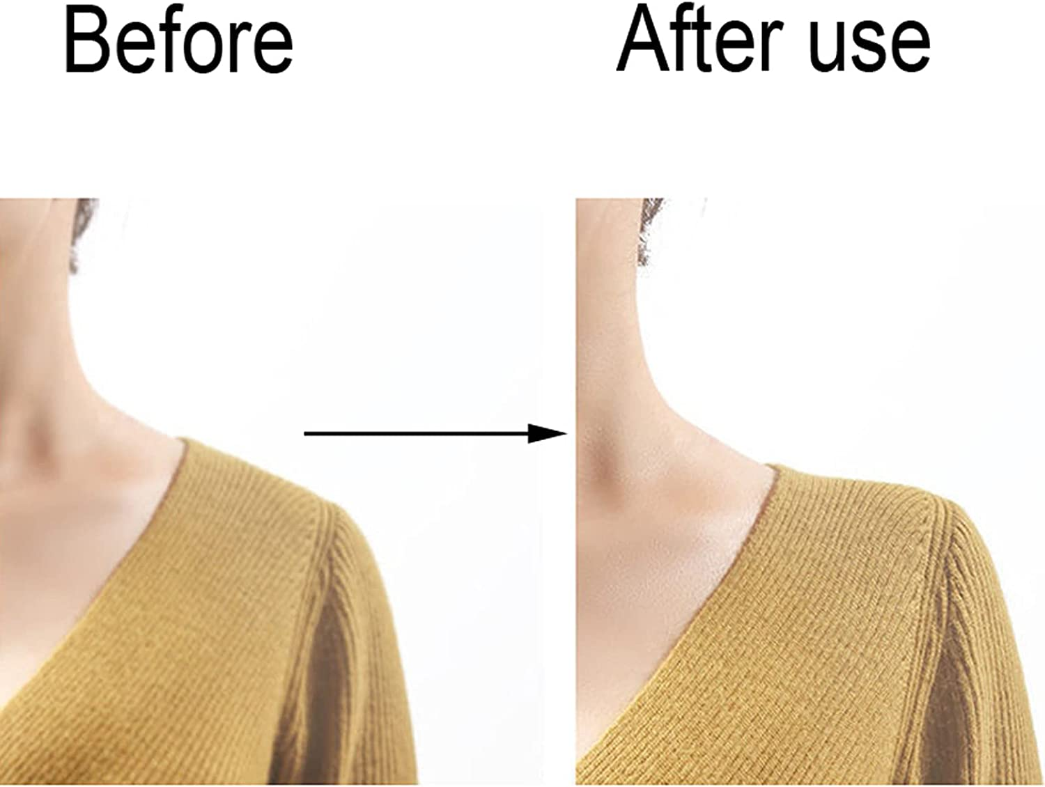 TRADERPLUS 2 Pairs Silicone Shoulder Pads for Womens Clothing Reusable anti Slip Shoulder Pads Invisible Shoulder Enhancer image number 1