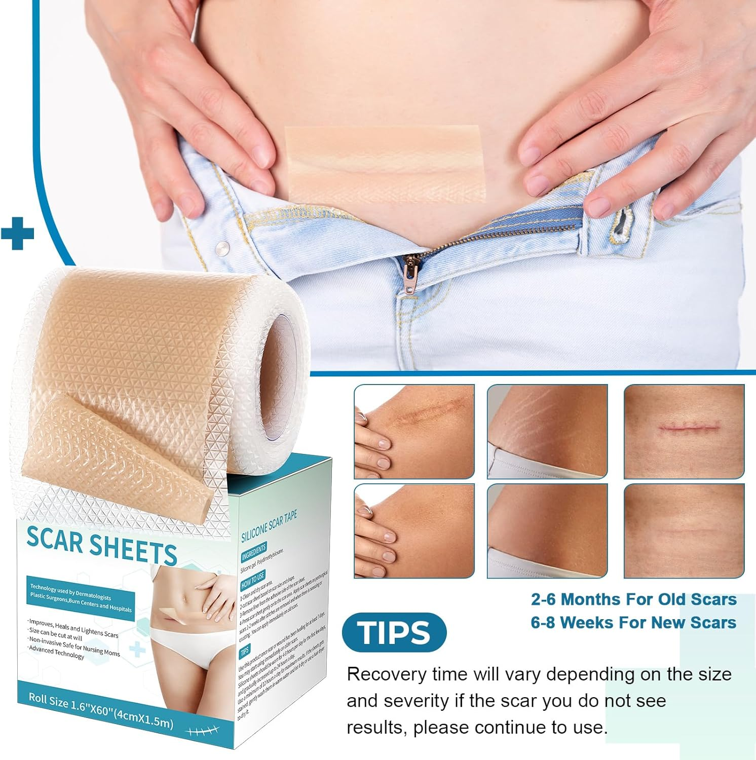 Silicone Scar Sheets, Silicone Scar Tape(1.6&rdquo;X 60&rdquo; Roll-1.5M), Silicone Scar Strips, Professional Scar Removal Sheets for Surgical Scars, Keloid, C-Section, Burn Et image number 6